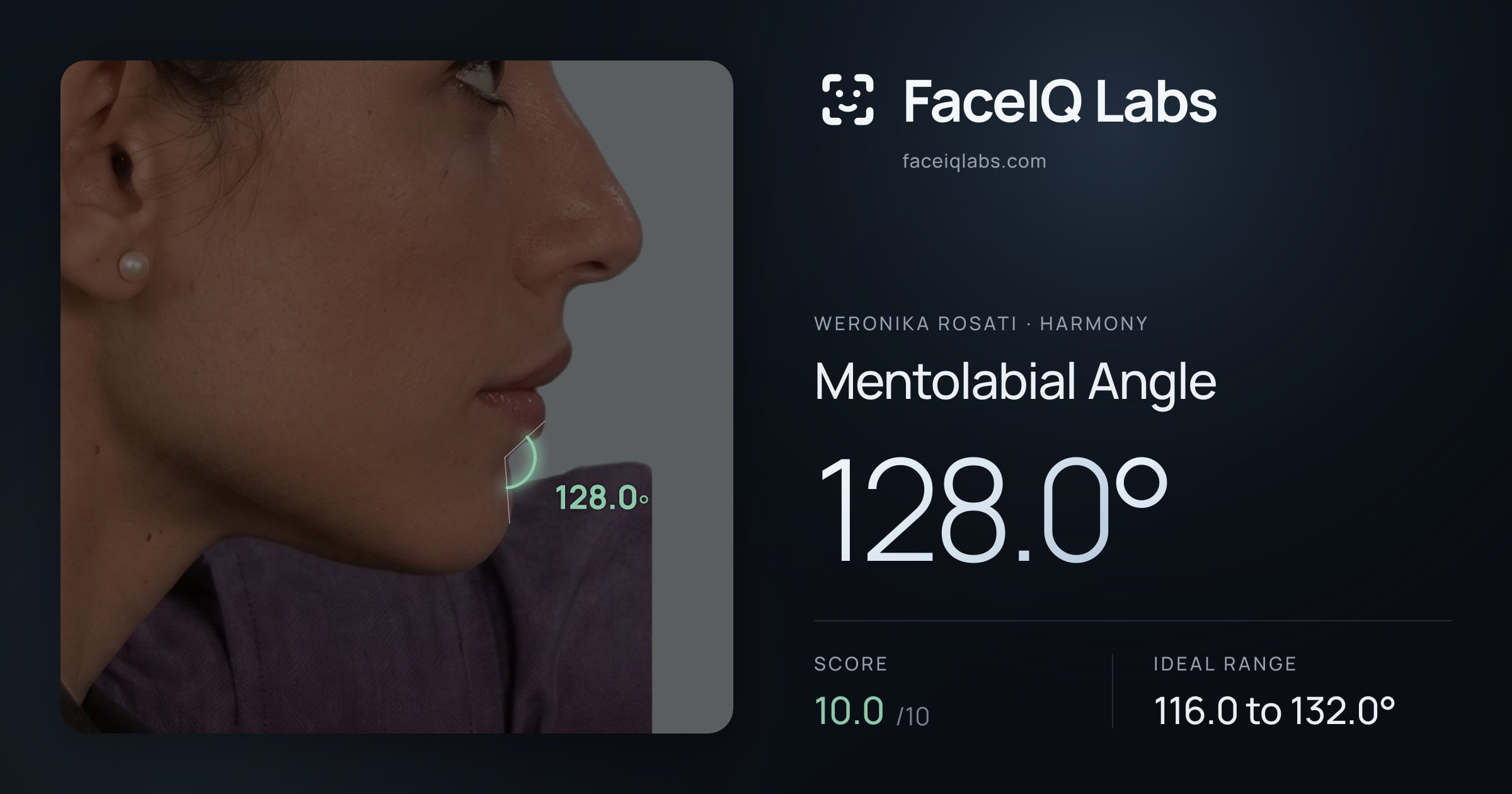 Weronika Rosati Mentolabial Angle: 128.0°, drawn on the photo