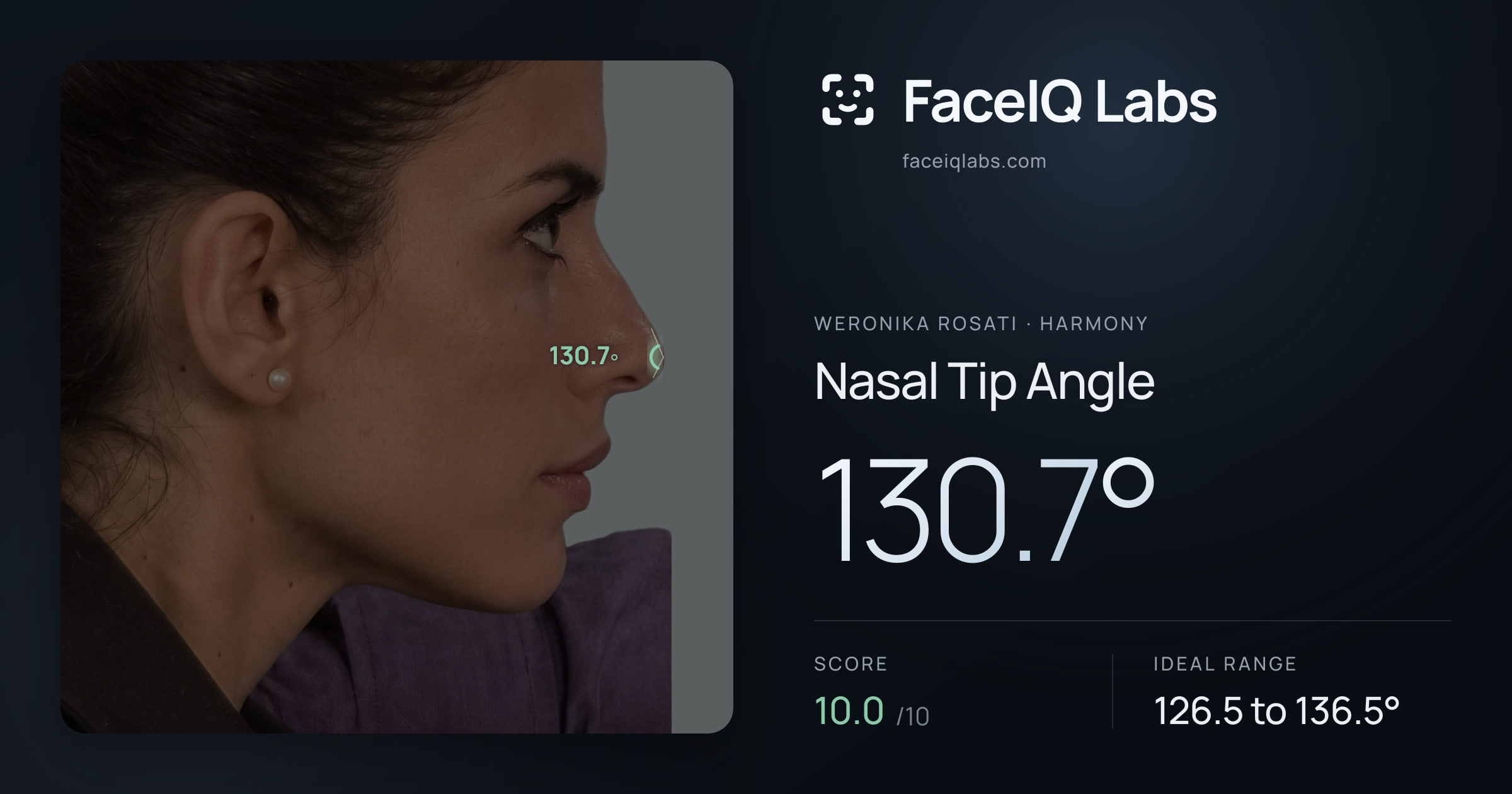 Weronika Rosati Nasal Tip Angle: 130.7°, drawn on the photo