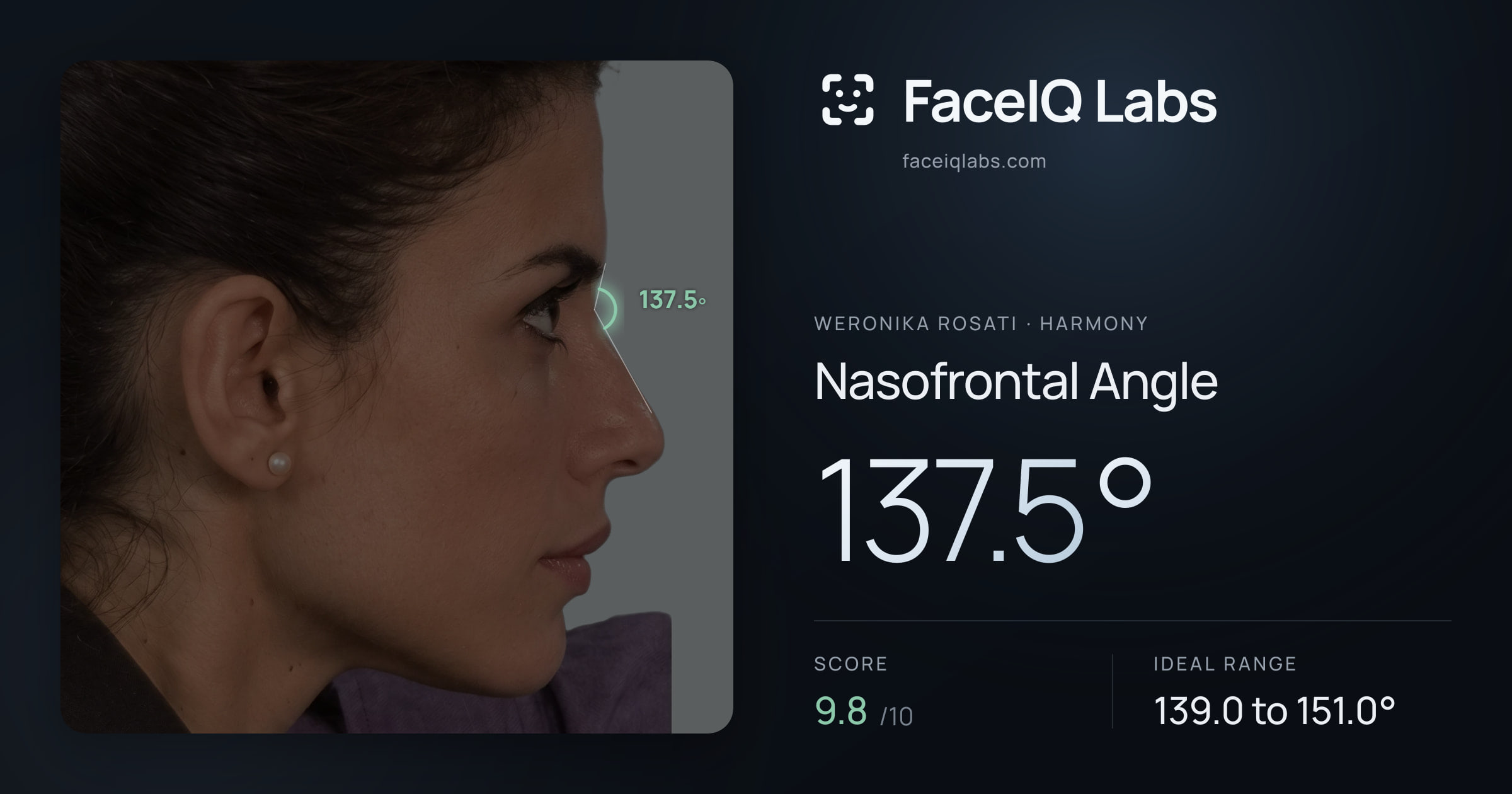 Weronika Rosati Nasofrontal Angle: 137.5°, drawn on the photo