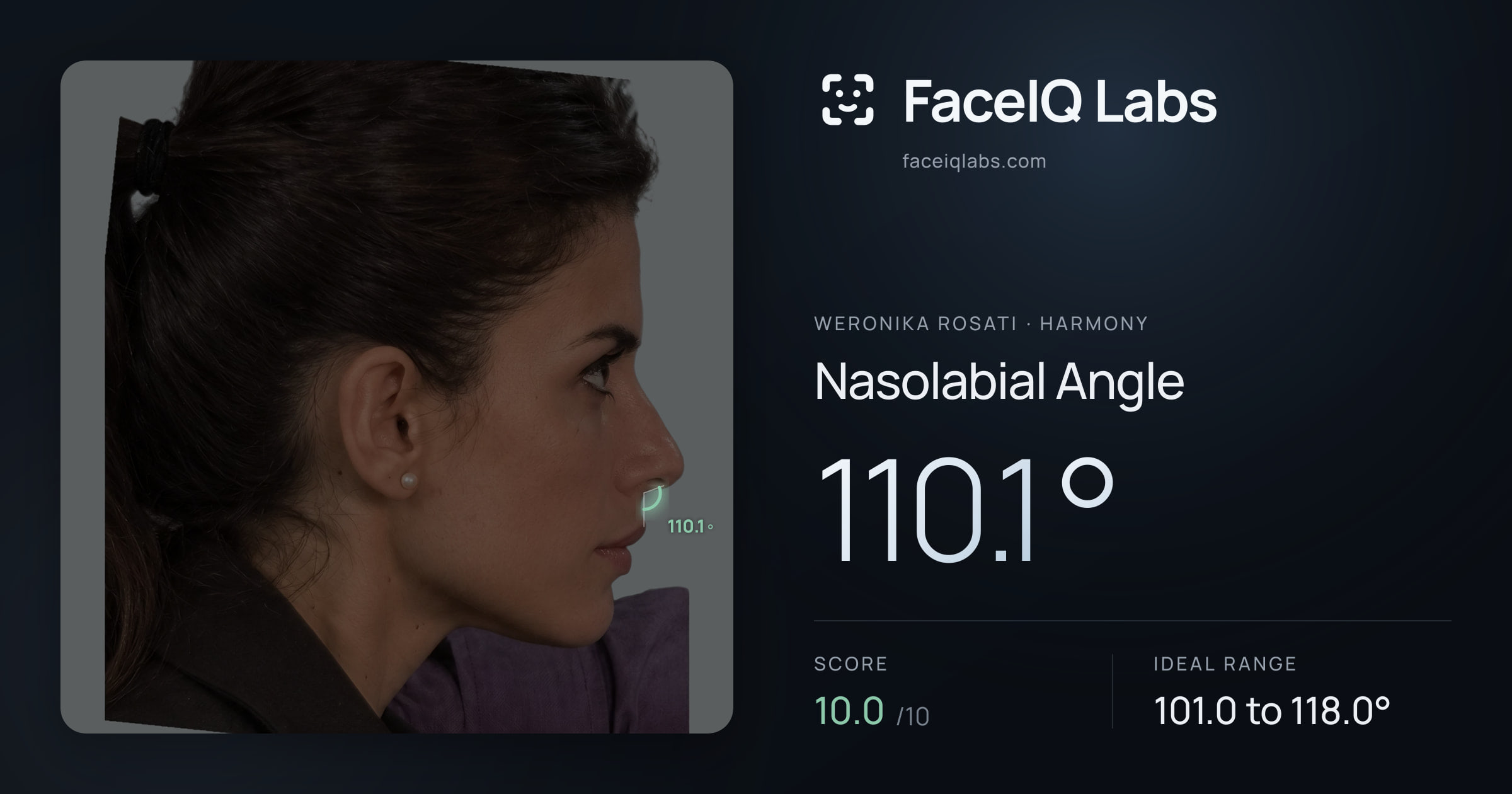 Weronika Rosati Nasolabial Angle: 110.1°, drawn on the photo
