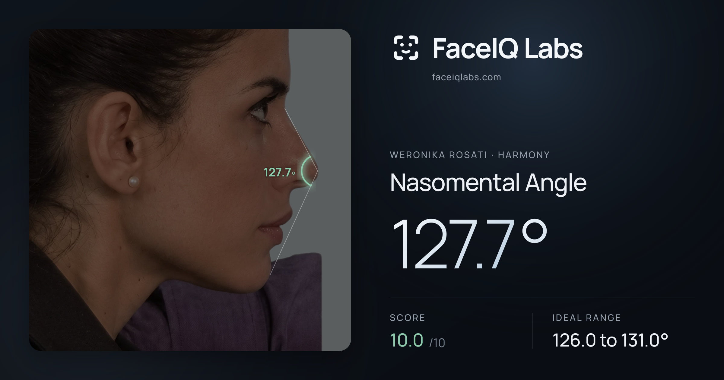 Weronika Rosati Nasomental Angle: 127.7°, drawn on the photo
