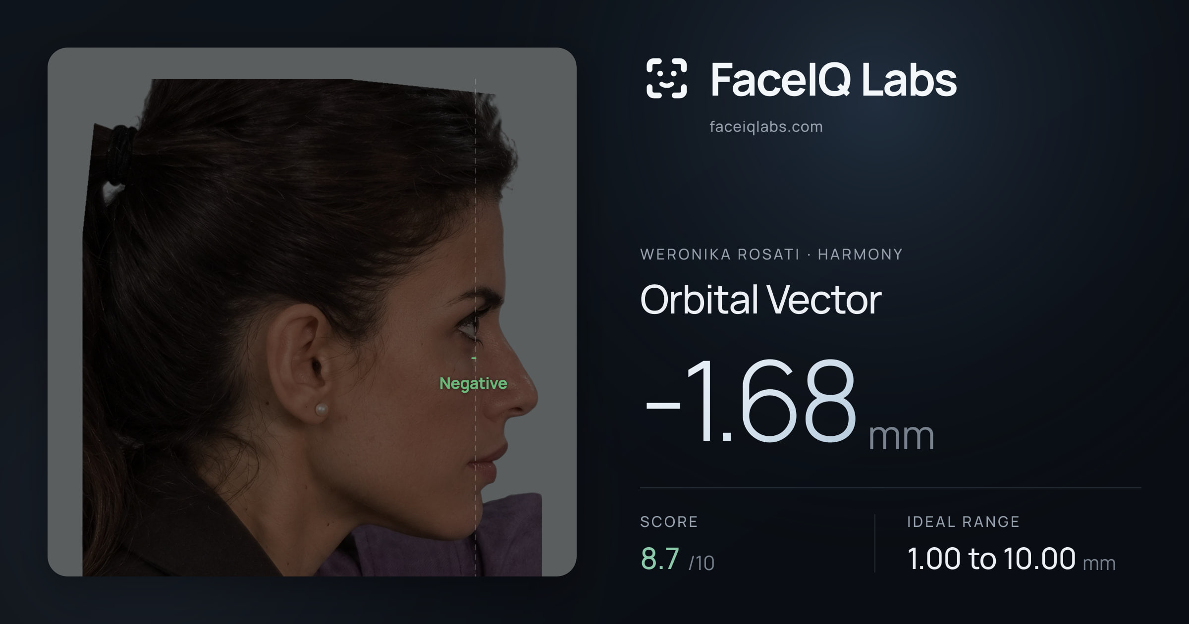 Weronika Rosati Orbital Vector: -1.68mm, drawn on the photo
