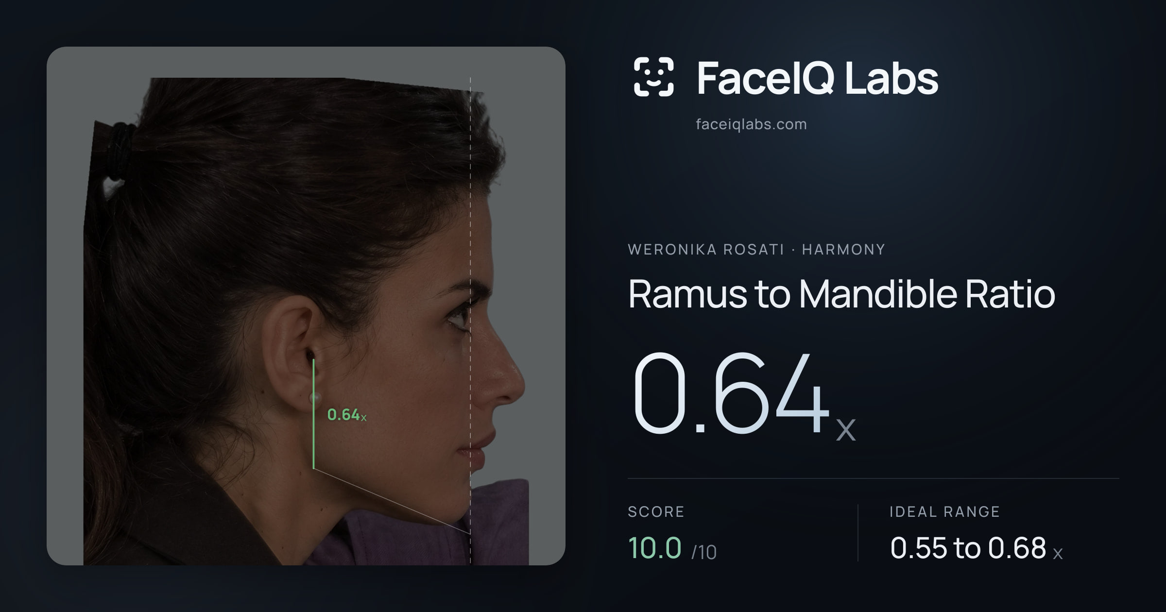Weronika Rosati Ramus to Mandible Ratio: 0.64x, drawn on the photo