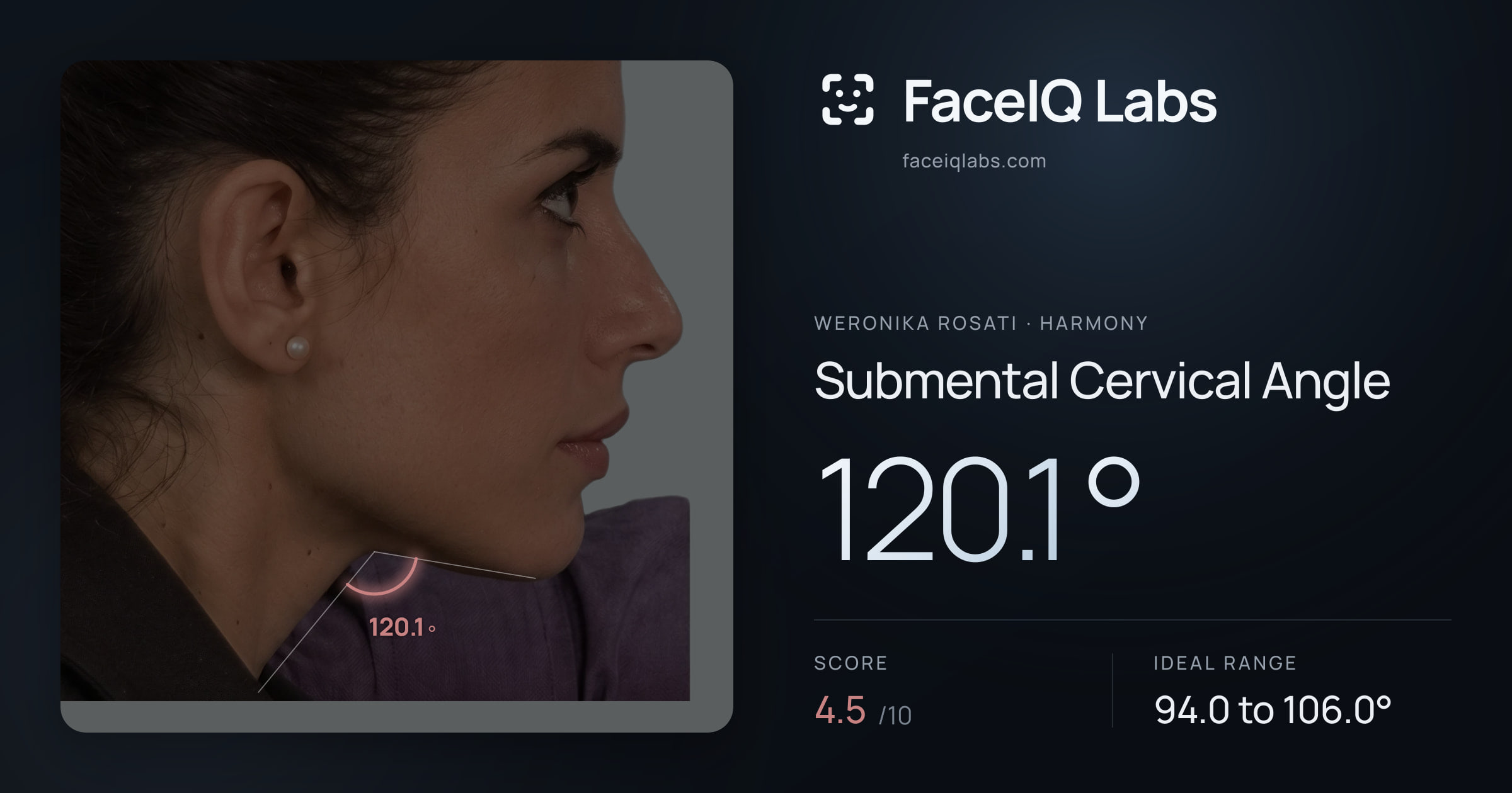 Weronika Rosati Submental Cervical Angle: 120.1°, drawn on the photo