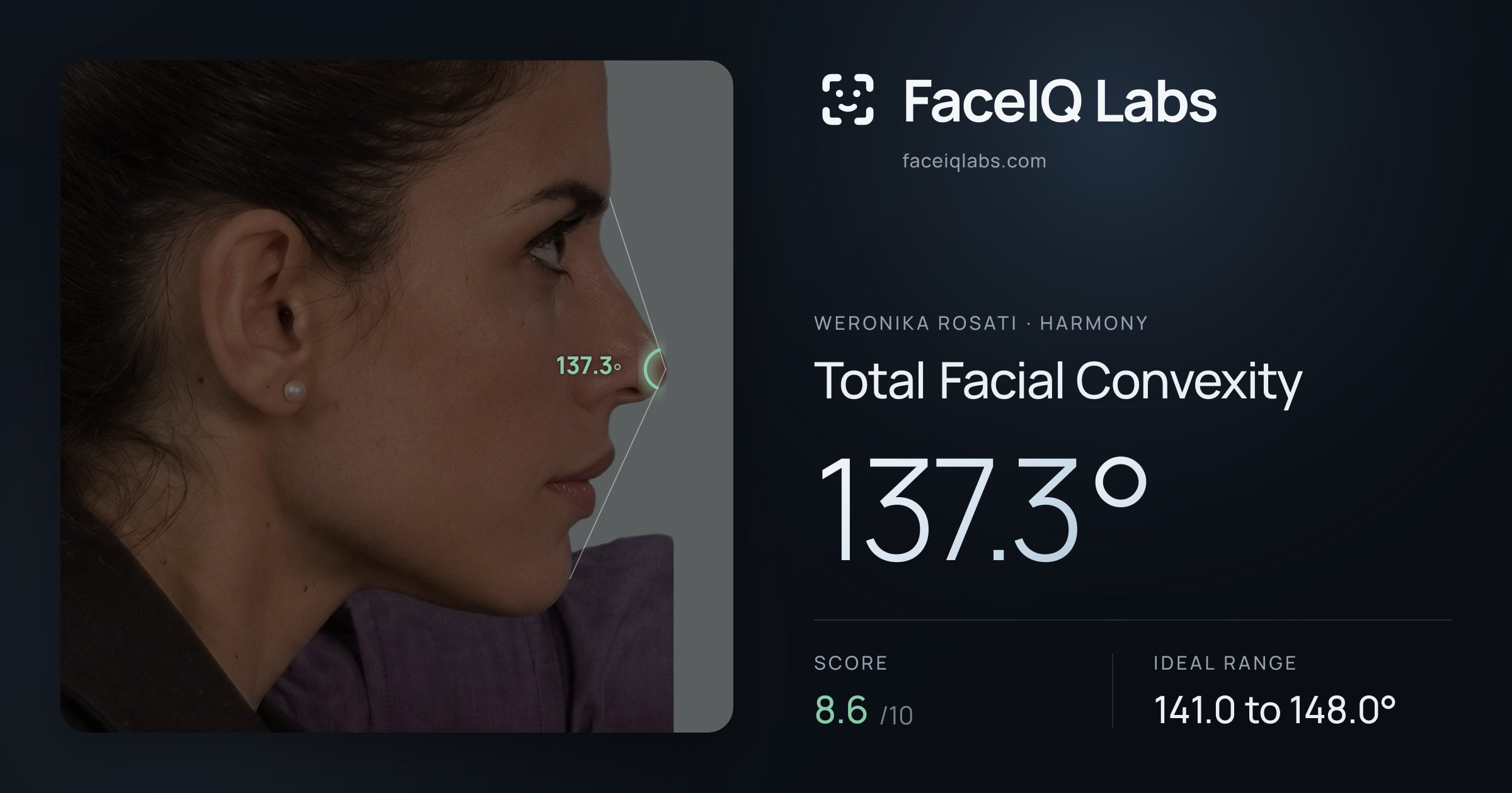 Weronika Rosati Total Facial Convexity: 137.3°, drawn on the photo