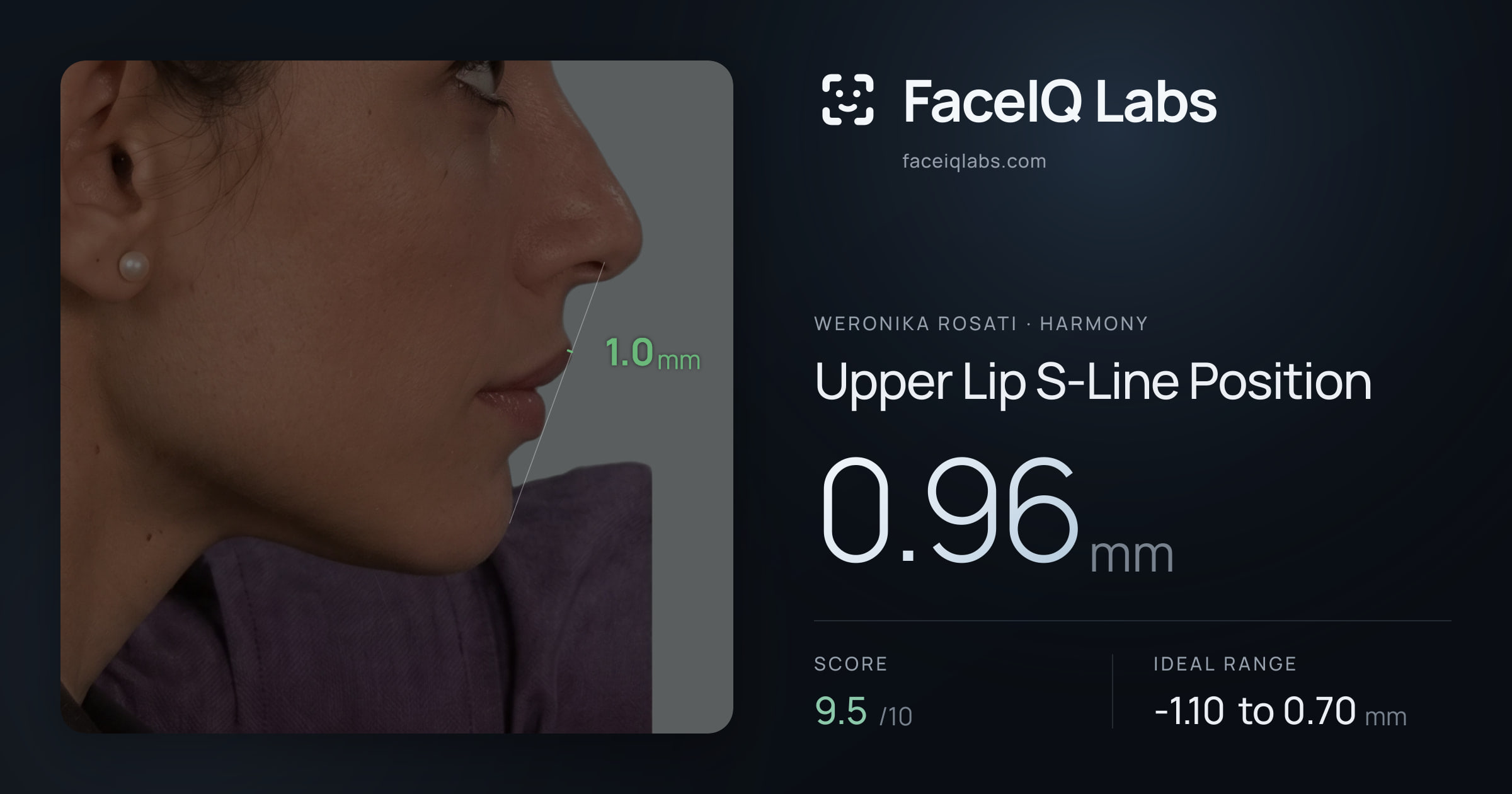 Weronika Rosati Upper Lip S-Line Position: 0.96mm, drawn on the photo