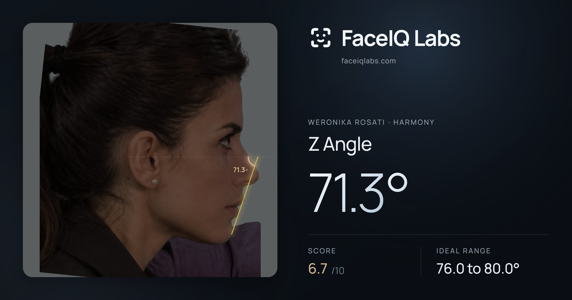 Weronika Rosati Z Angle: 71.3°, drawn on the photo