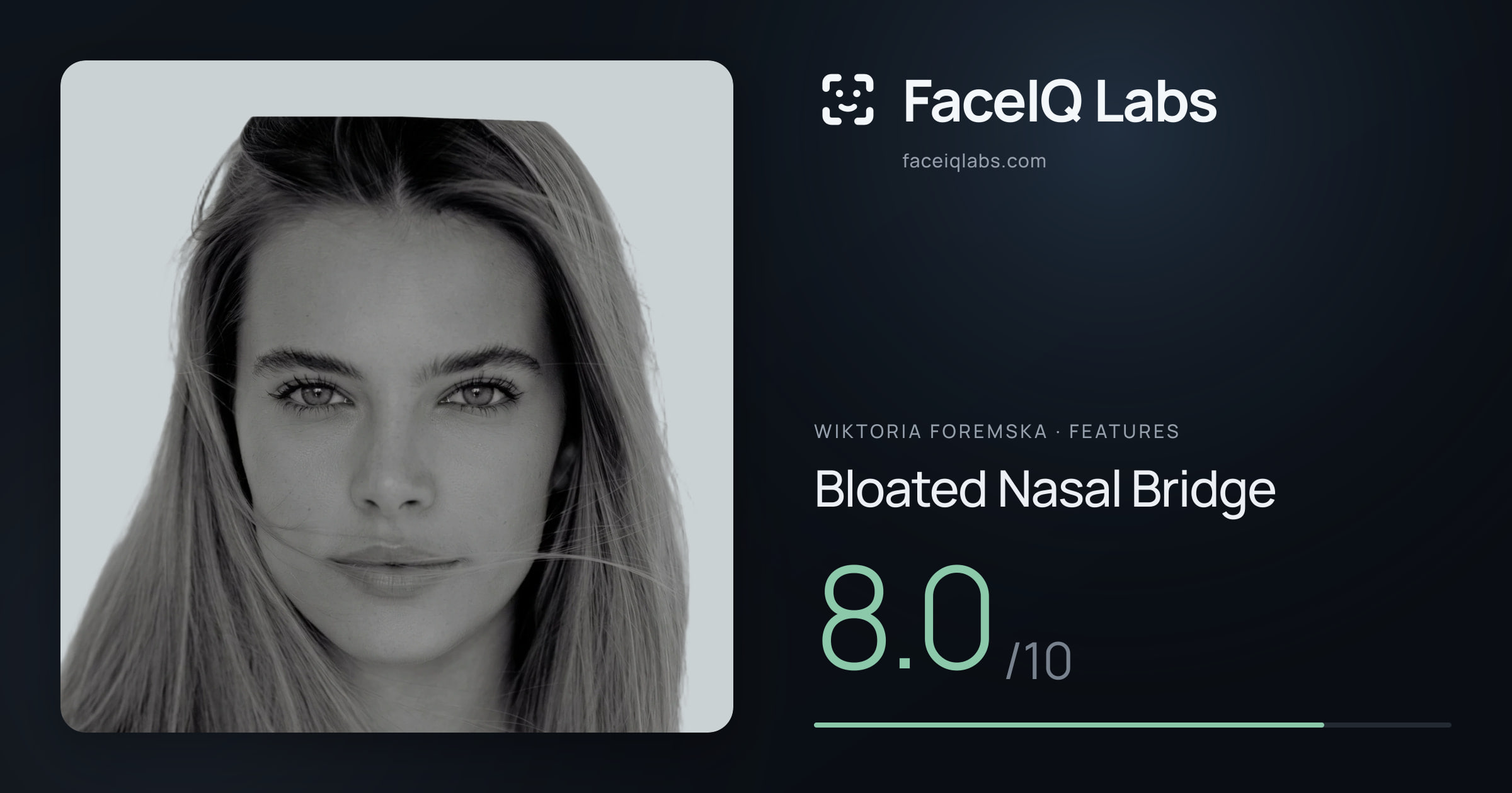 Wiktoria Foremska Bloated Nasal Bridge: 8.0/10, drawn on the photo