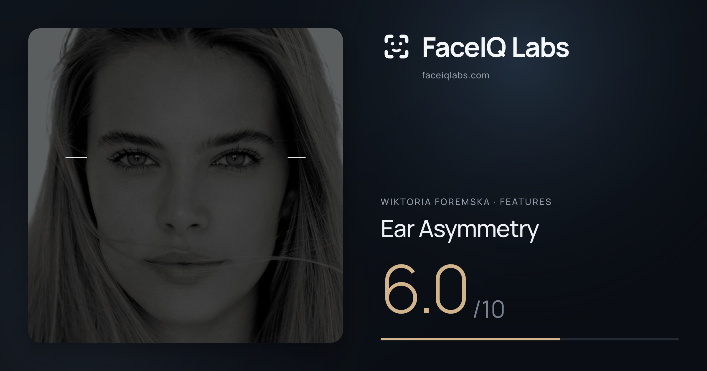 Wiktoria Foremska Ear Asymmetry: 6.0/10, drawn on the photo