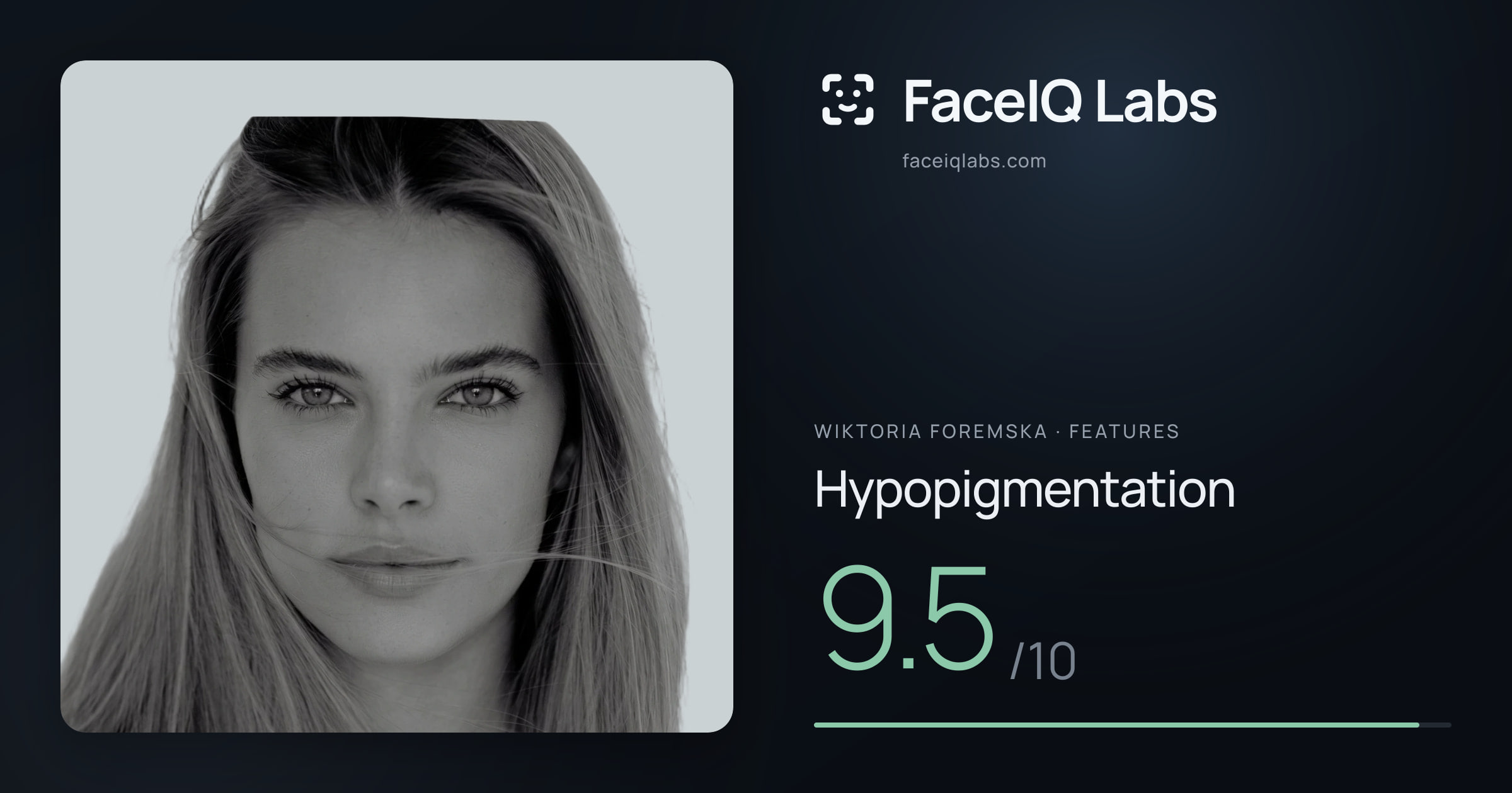 Wiktoria Foremska Hypopigmentation: 9.5/10, drawn on the photo