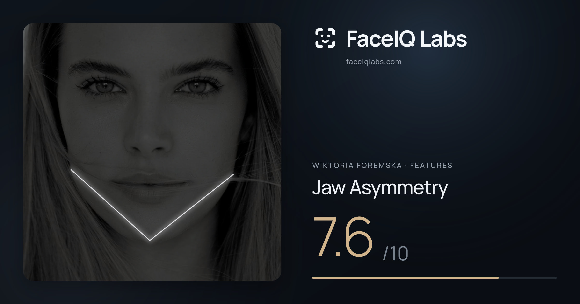 Wiktoria Foremska Jaw Asymmetry: 7.6/10, drawn on the photo