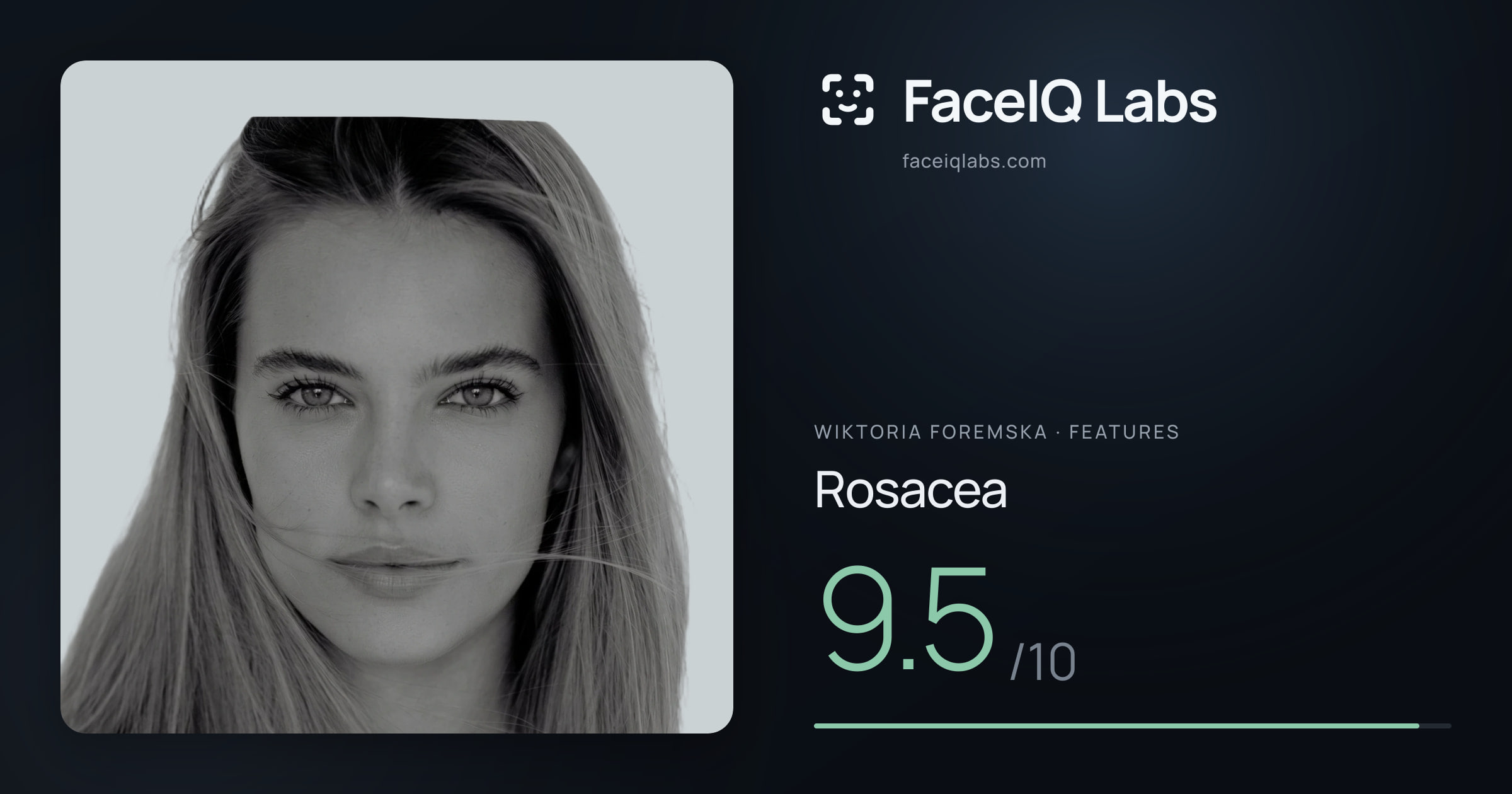 Wiktoria Foremska Rosacea: 9.5/10, drawn on the photo