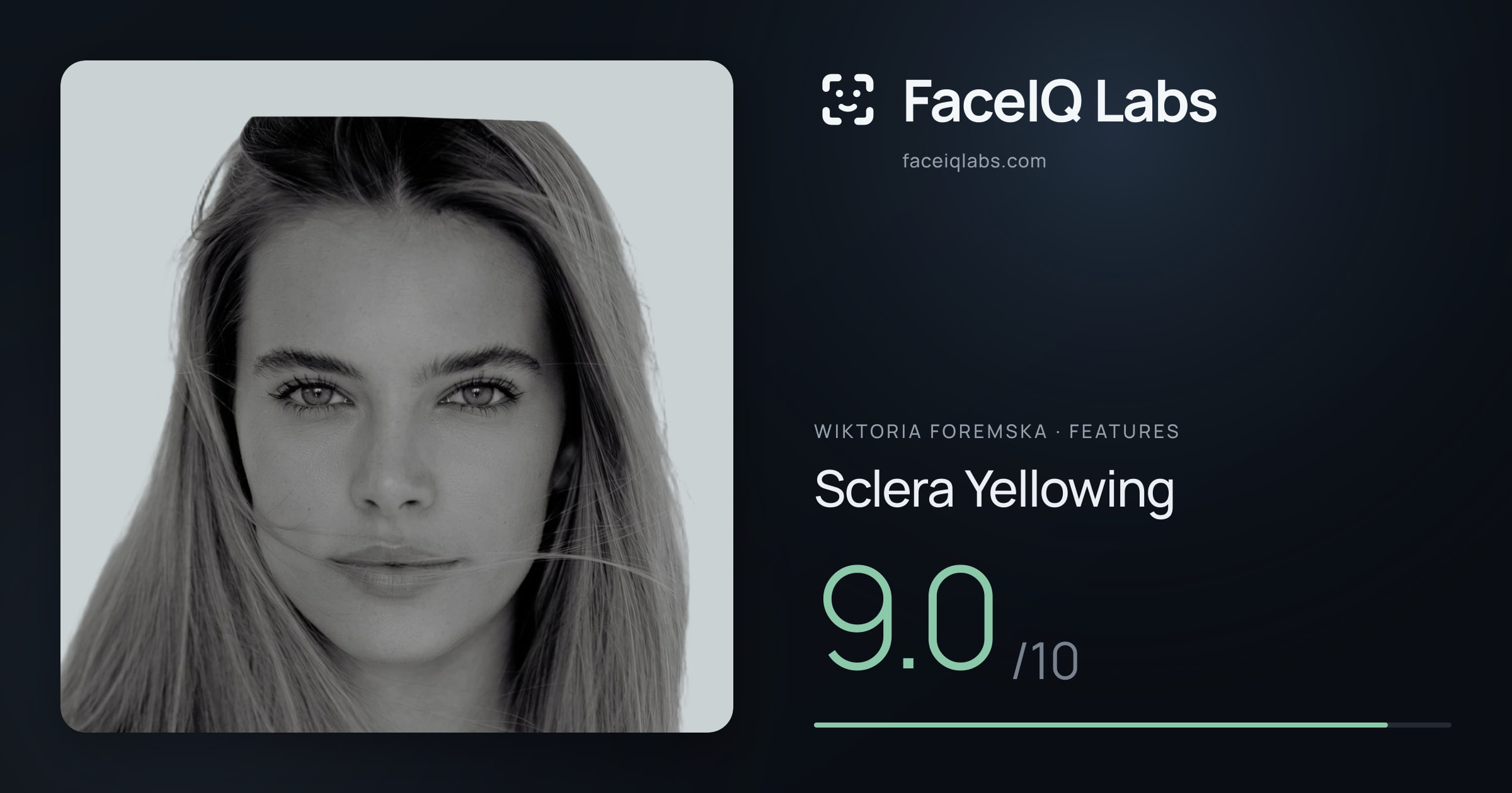 Wiktoria Foremska Sclera Yellowing: 9.0/10, drawn on the photo