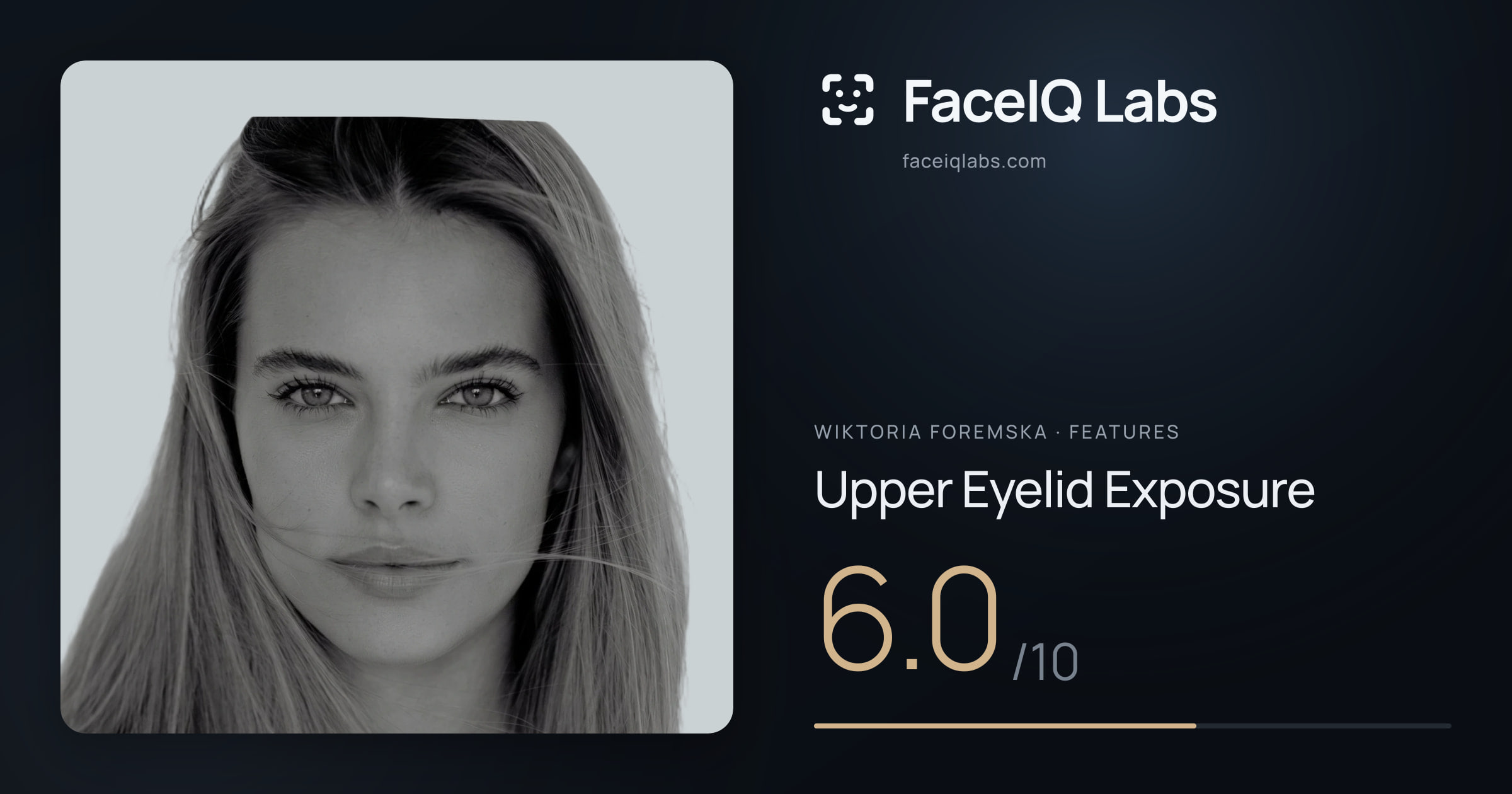 Wiktoria Foremska Upper Eyelid Exposure: 6.0/10, drawn on the photo