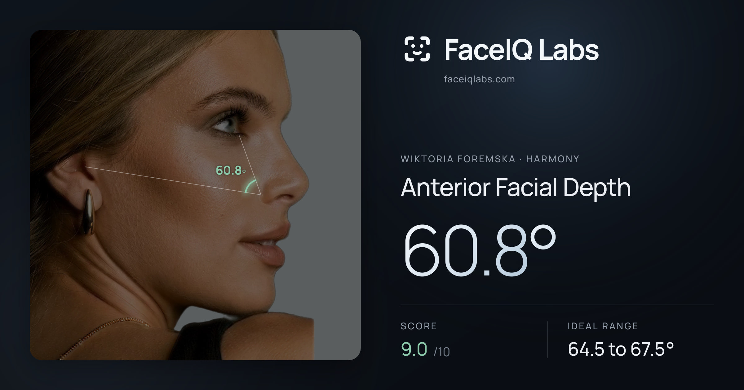 Wiktoria Foremska Anterior Facial Depth: 60.8°, drawn on the photo