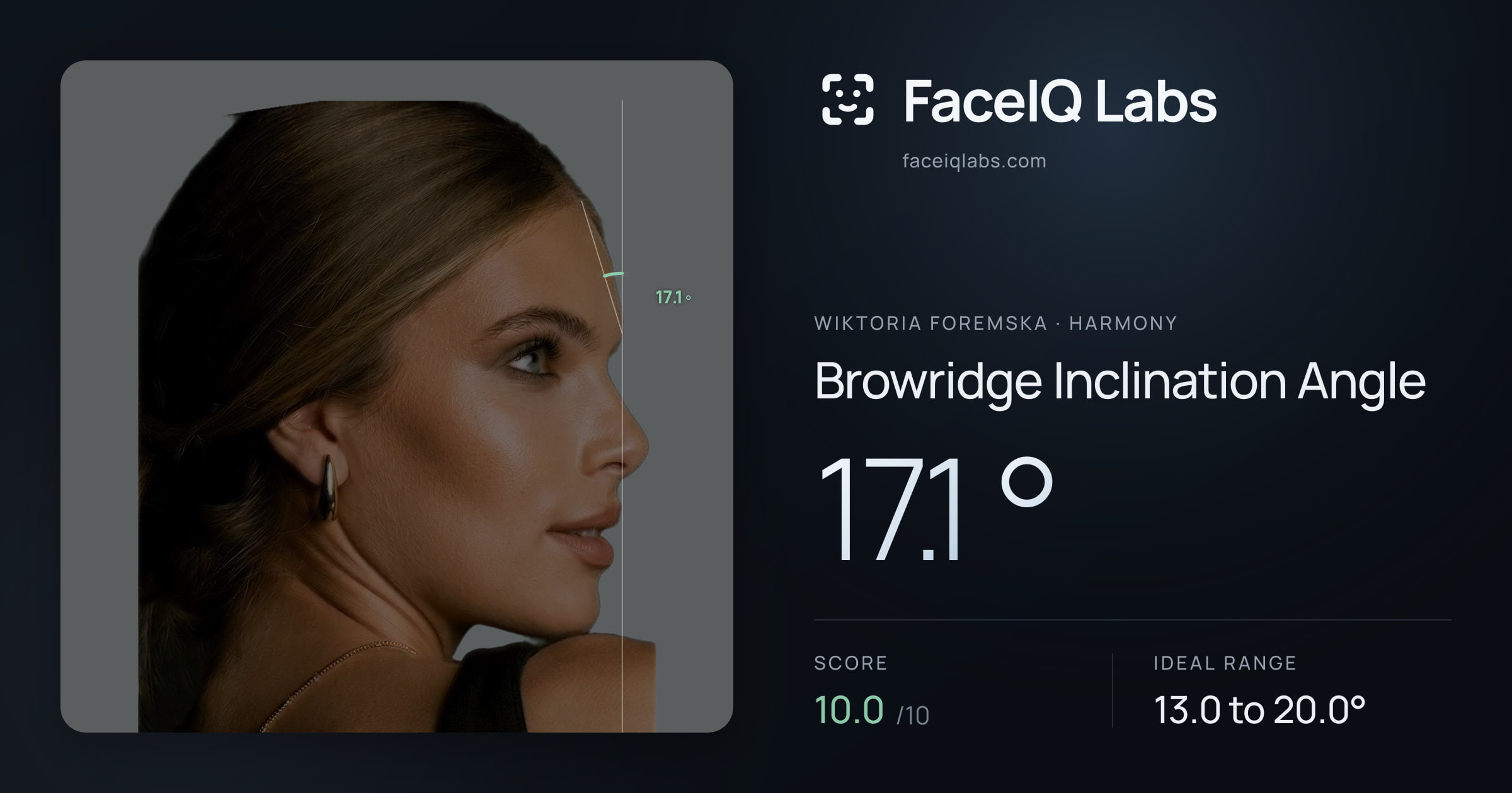 Wiktoria Foremska Browridge Inclination Angle: 17.1°, drawn on the photo