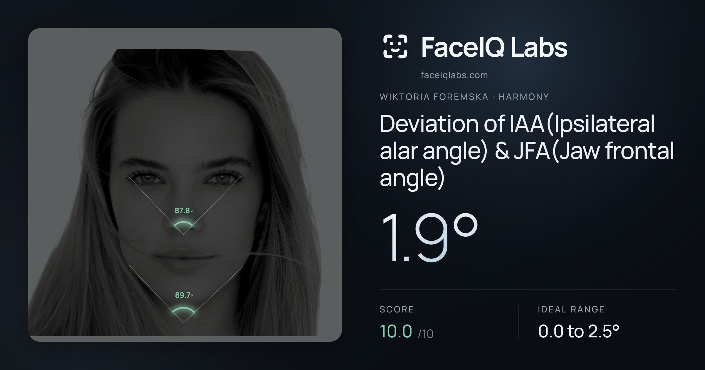 Wiktoria Foremska Deviation of IAA(Ipsilateral alar angle) & JFA(Jaw frontal angle): 1.9°, drawn on the photo