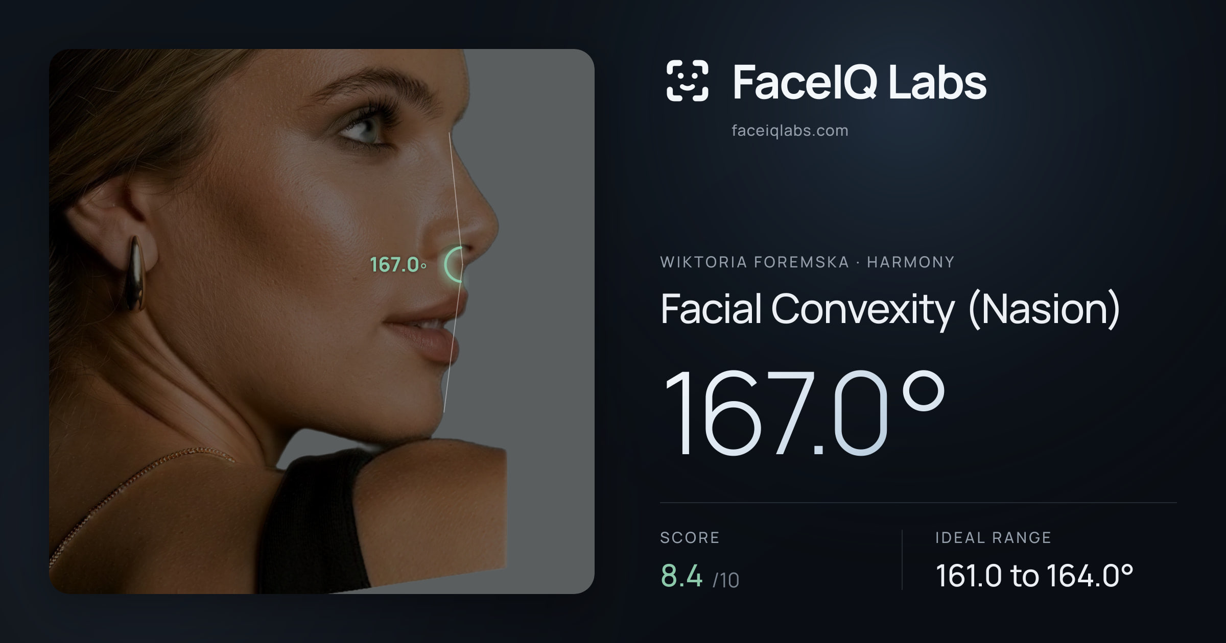 Wiktoria Foremska Facial Convexity (Nasion): 167.0°, drawn on the photo