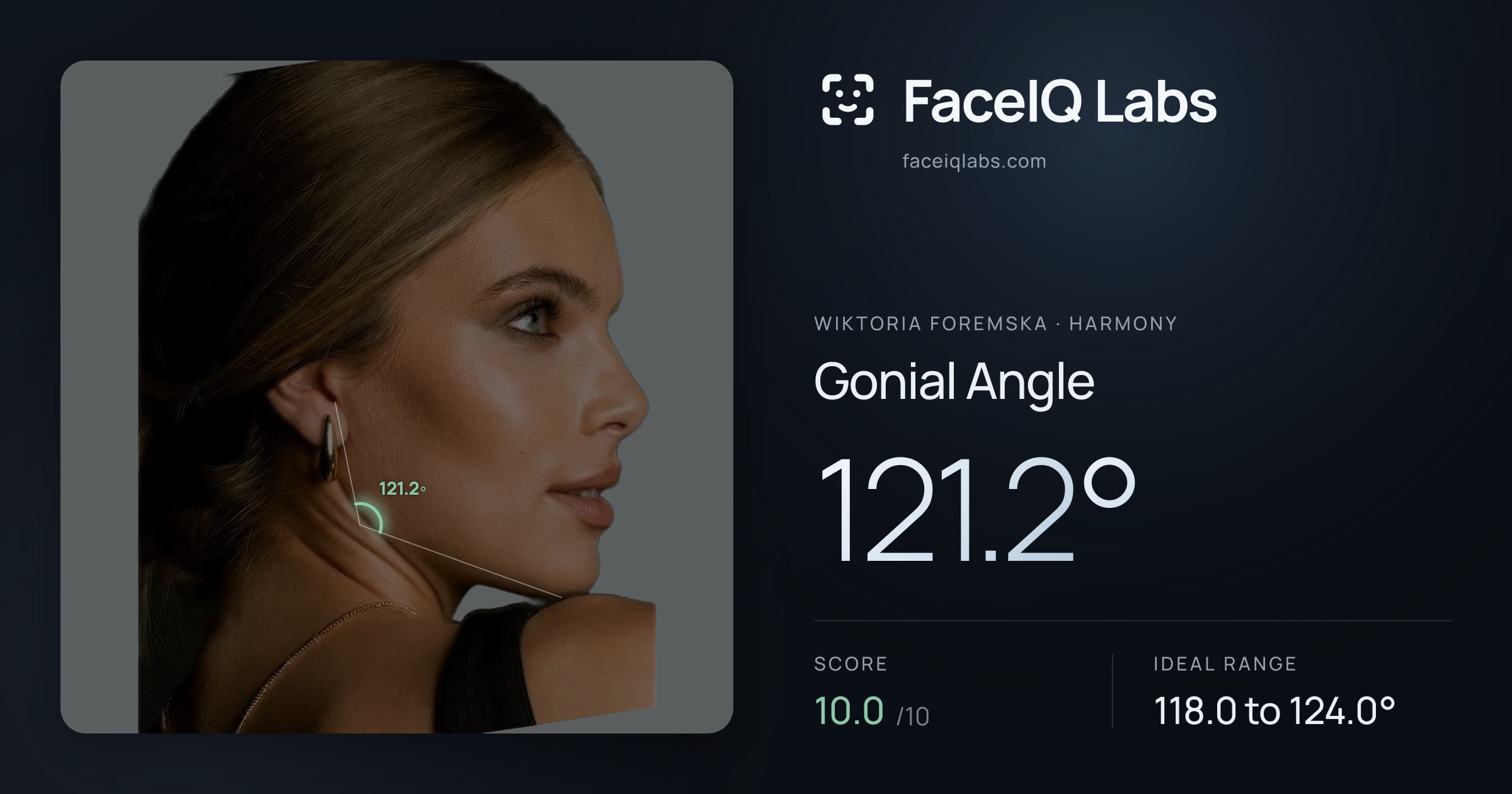 Wiktoria Foremska Gonial Angle: 121.2°, drawn on the photo