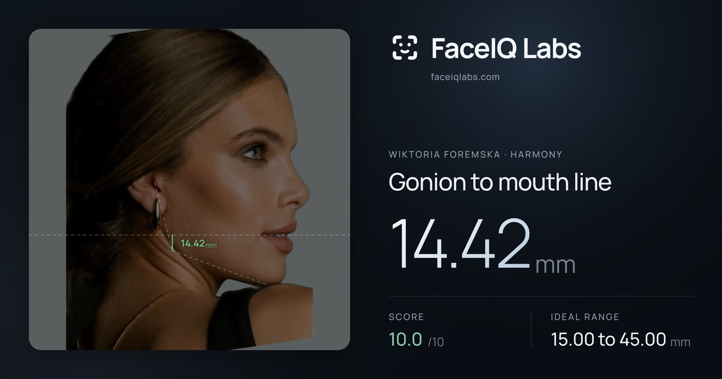Wiktoria Foremska Gonion to mouth line: 14.42mm, drawn on the photo