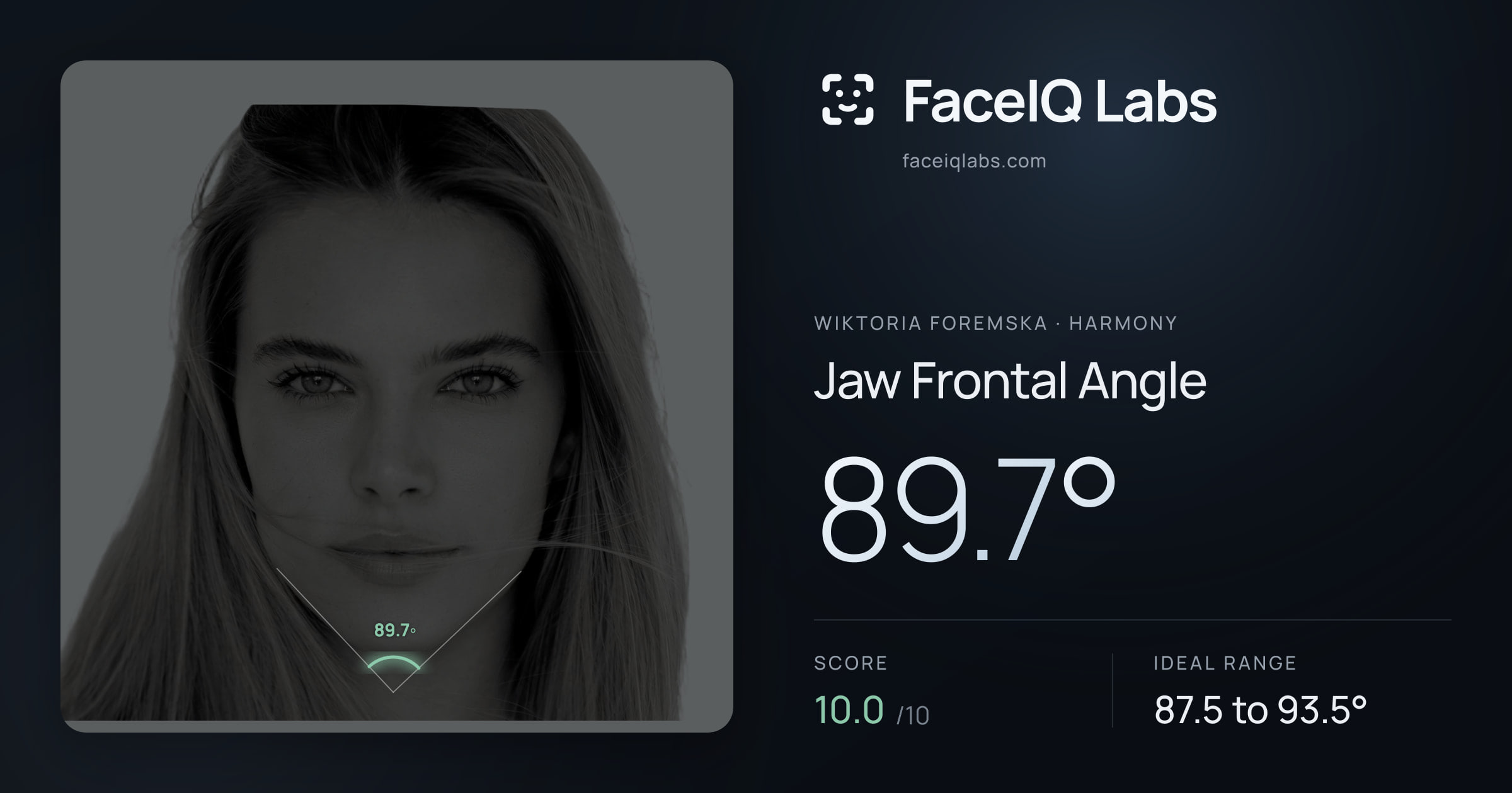 Wiktoria Foremska Jaw Frontal Angle: 89.7°, drawn on the photo