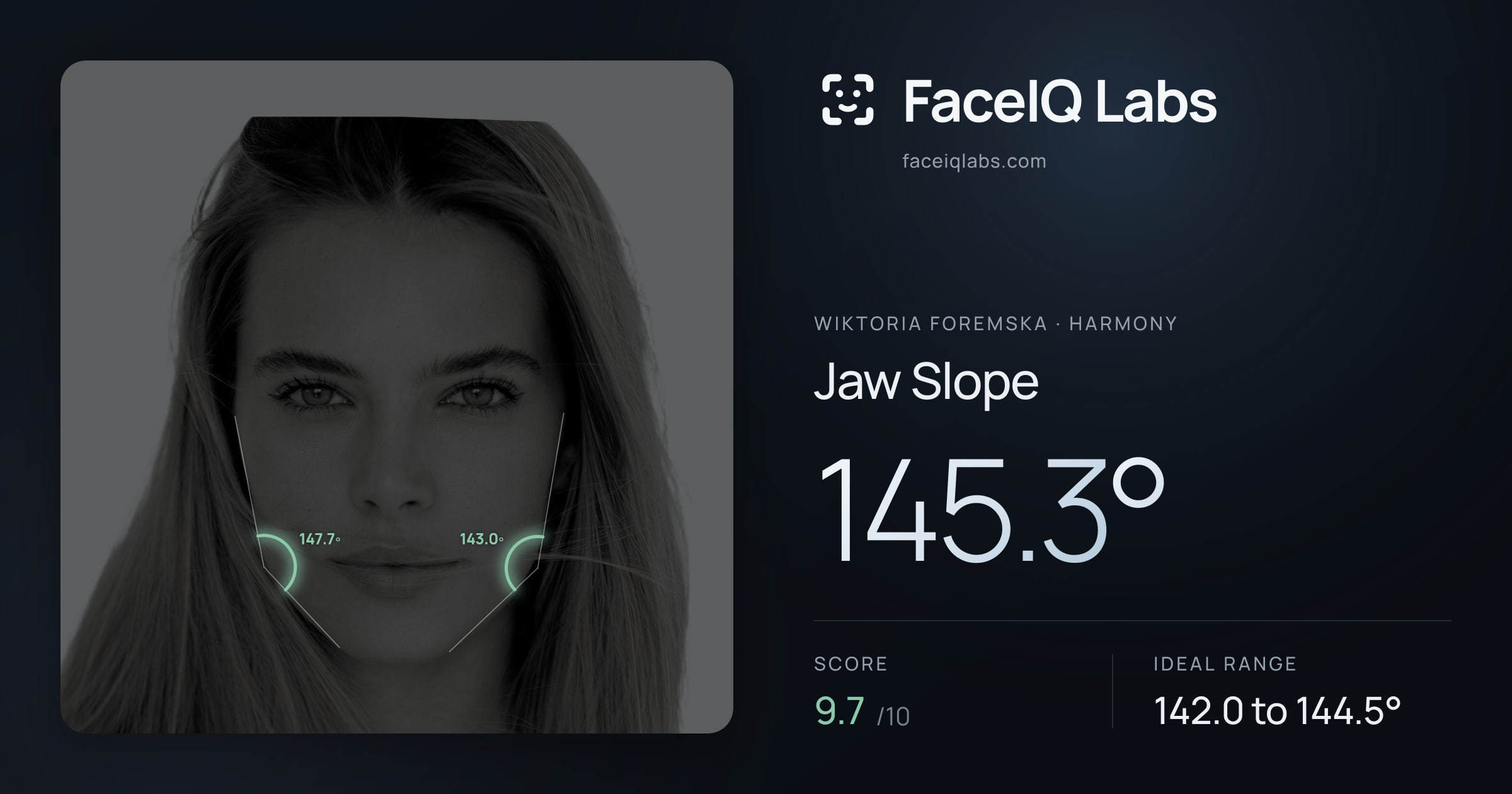 Wiktoria Foremska Jaw Slope: 145.3°, drawn on the photo