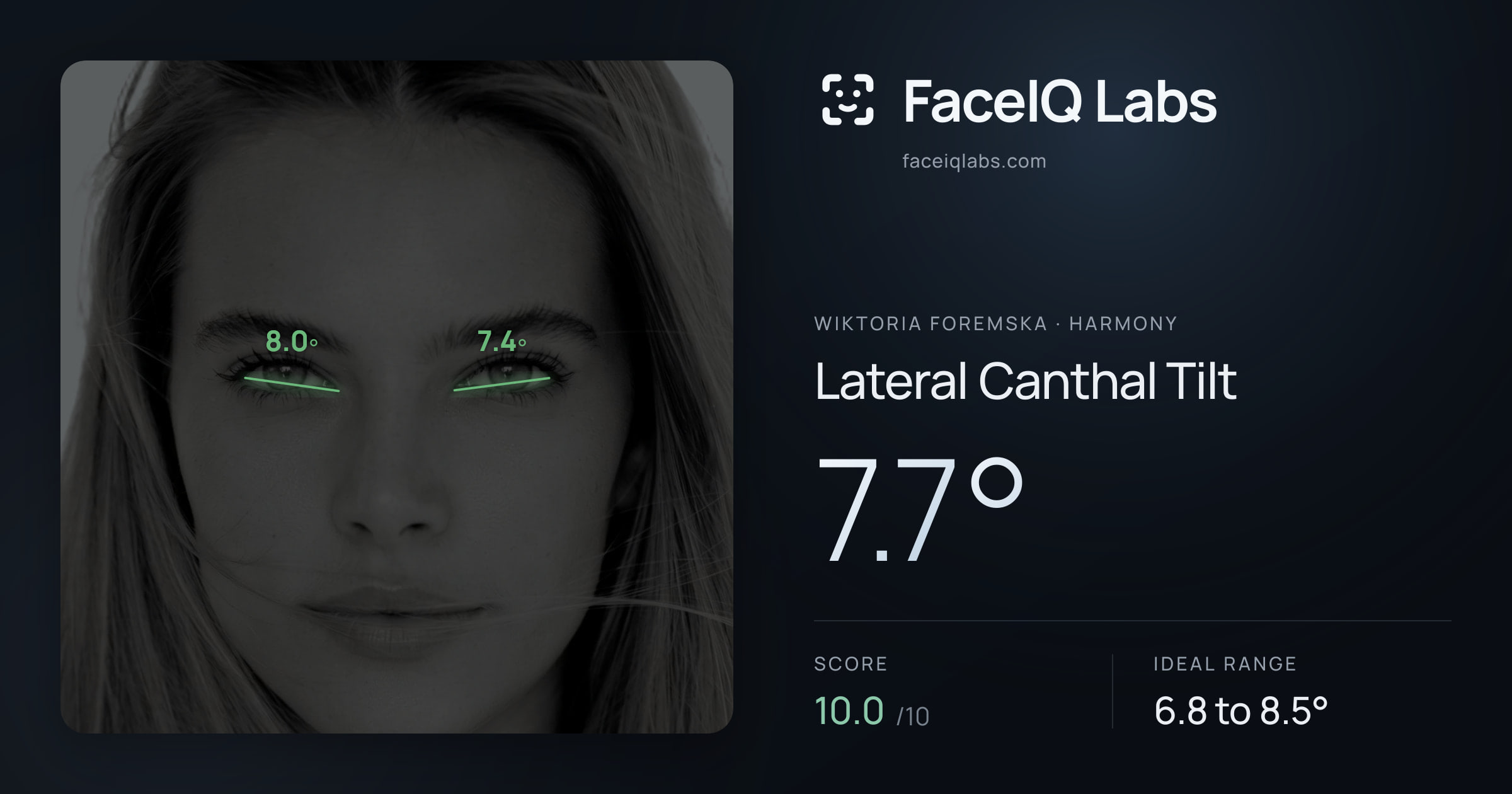 Wiktoria Foremska Lateral Canthal Tilt: 7.7°, drawn on the photo