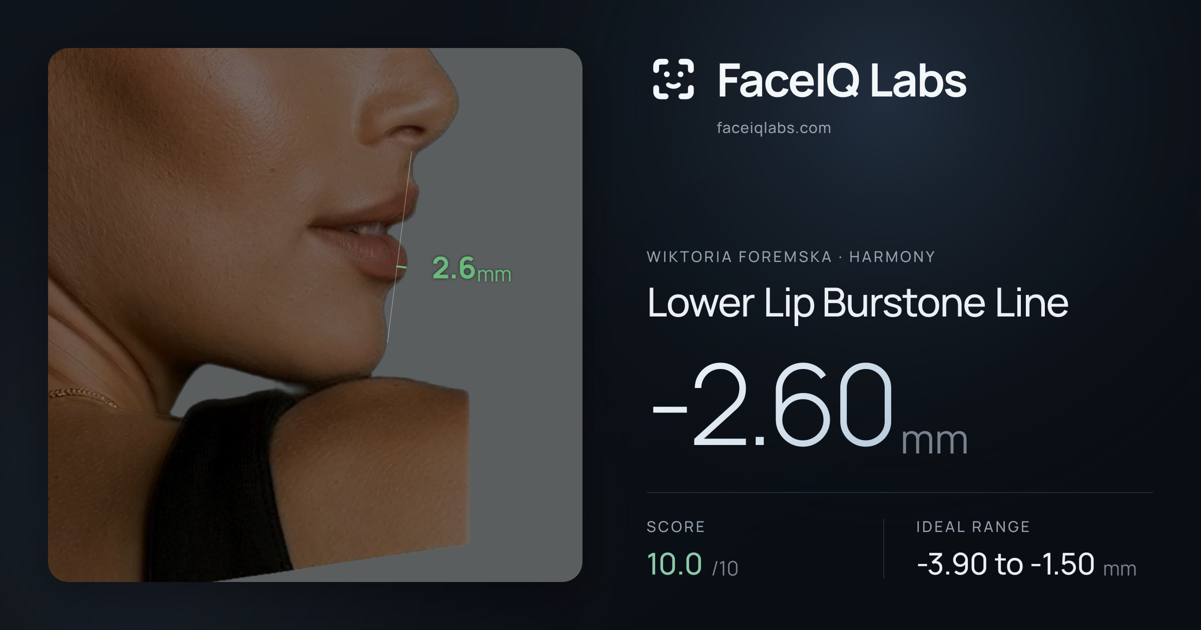 Wiktoria Foremska Lower Lip Burstone Line: -2.60mm, drawn on the photo
