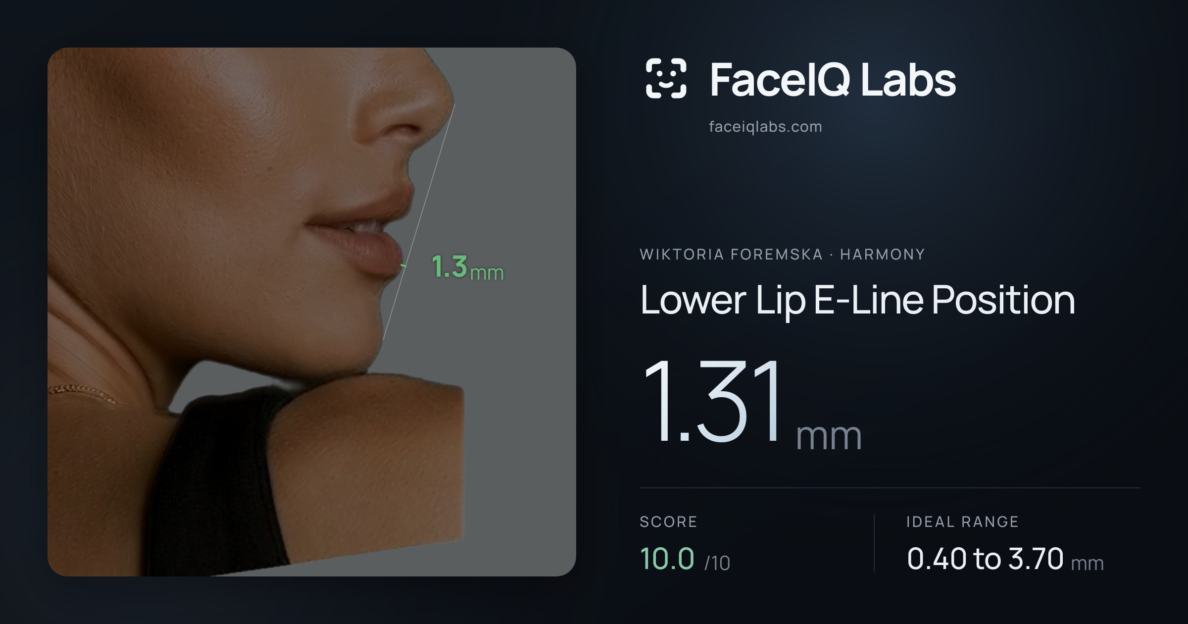 Wiktoria Foremska Lower Lip E-Line Position: 1.31mm, drawn on the photo
