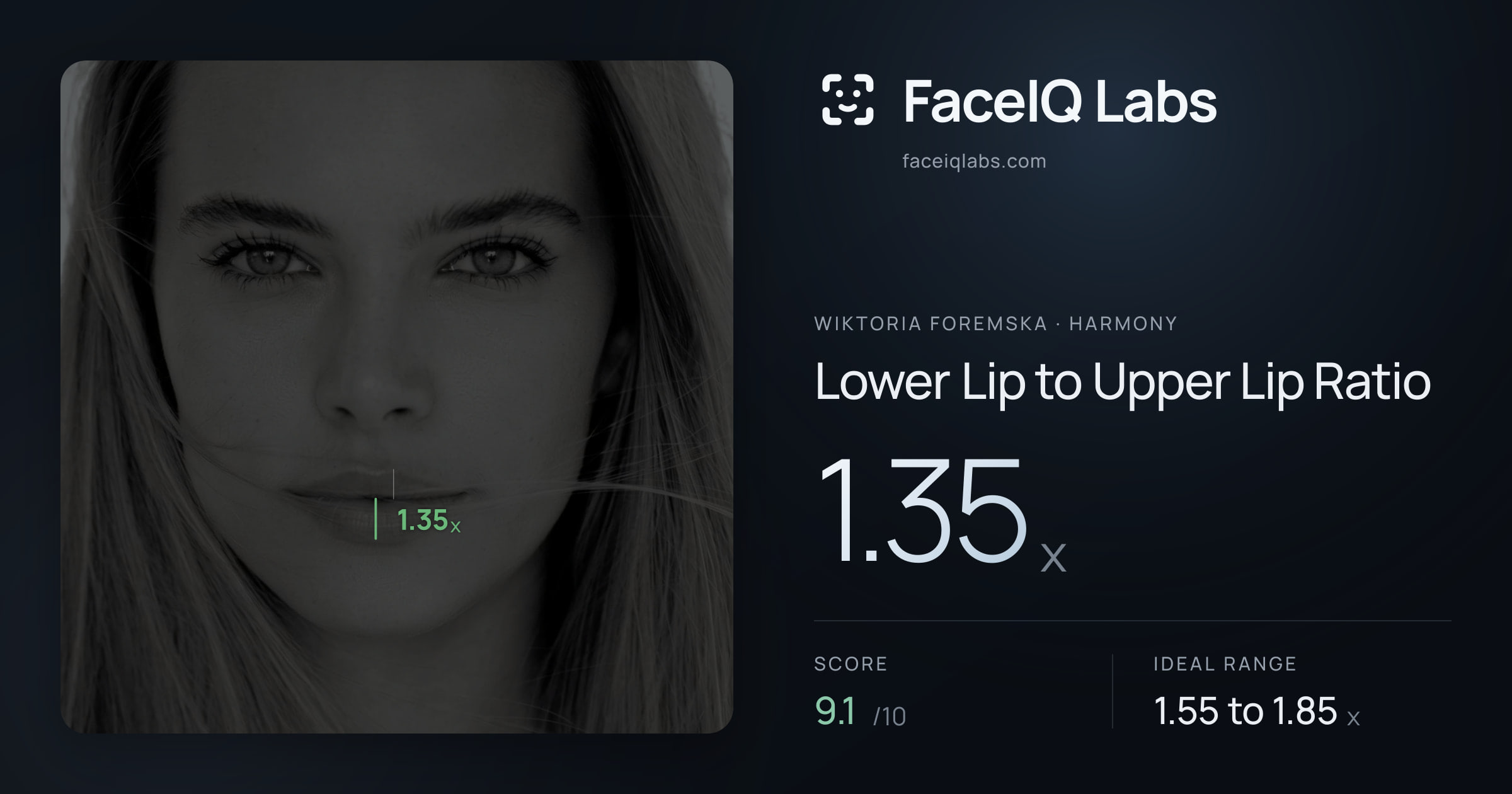 Wiktoria Foremska Lower Lip to Upper Lip Ratio: 1.35x, drawn on the photo