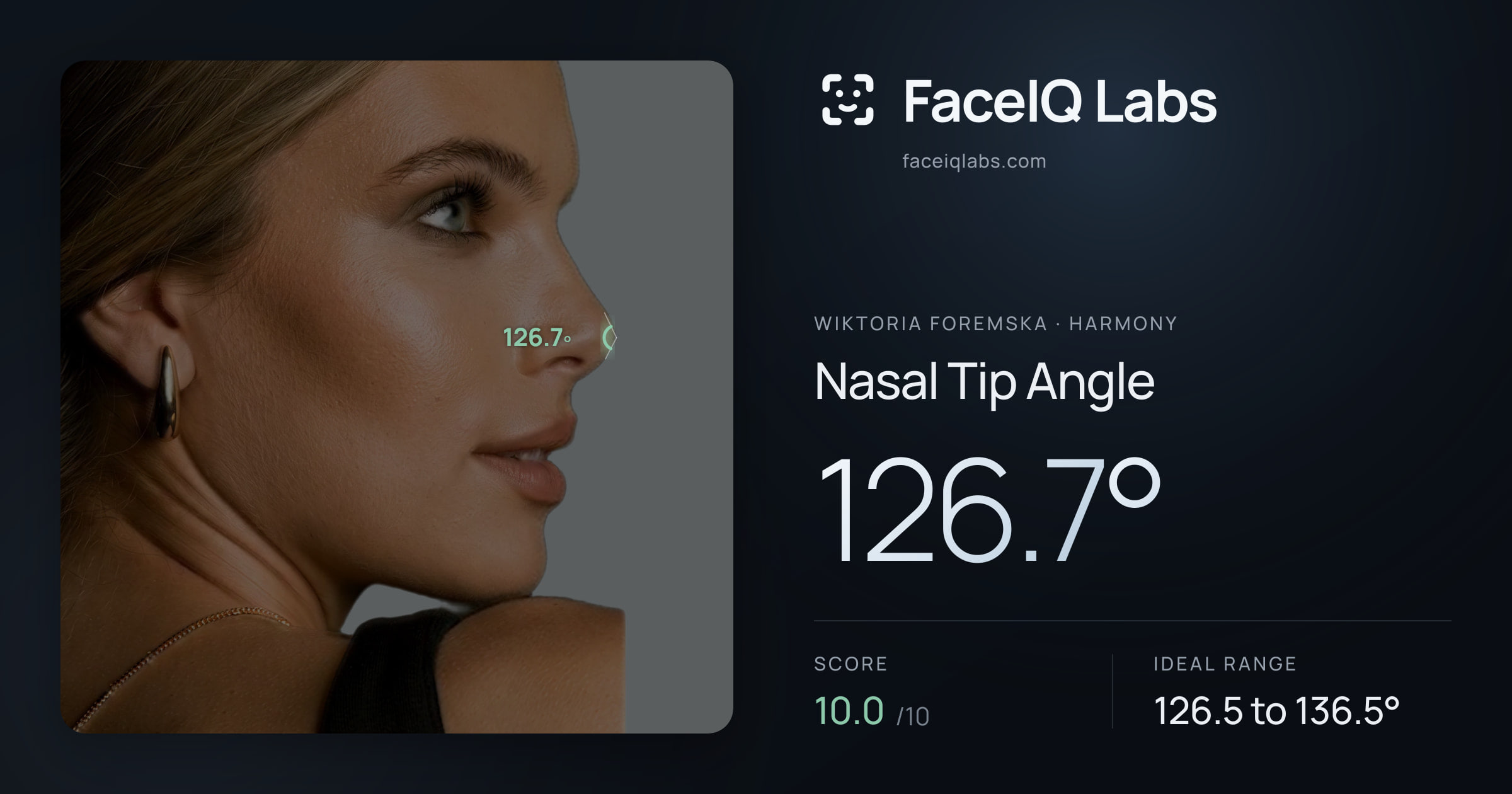 Wiktoria Foremska Nasal Tip Angle: 126.7°, drawn on the photo