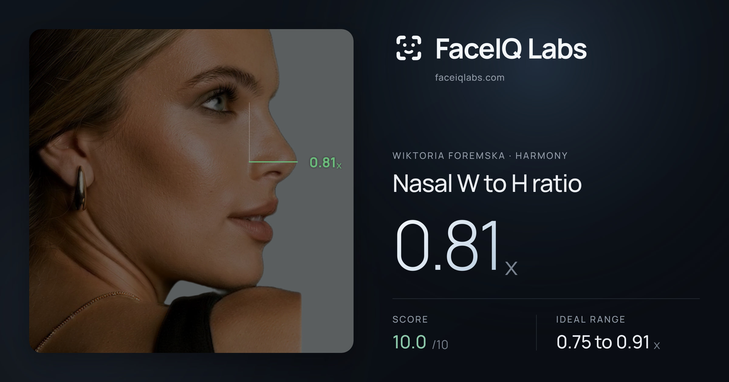 Wiktoria Foremska Nasal W to H ratio: 0.81x, drawn on the photo