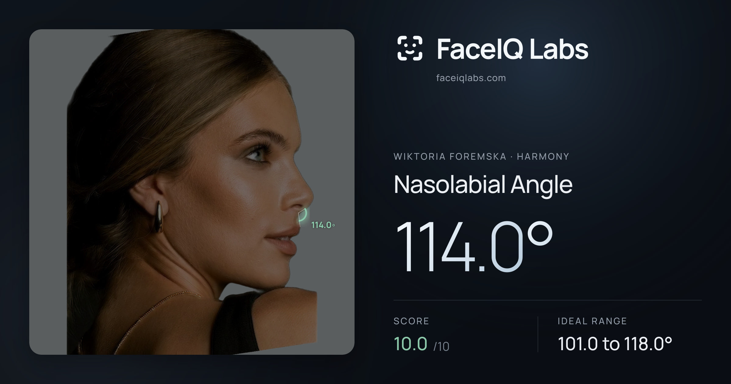 Wiktoria Foremska Nasolabial Angle: 114.0°, drawn on the photo
