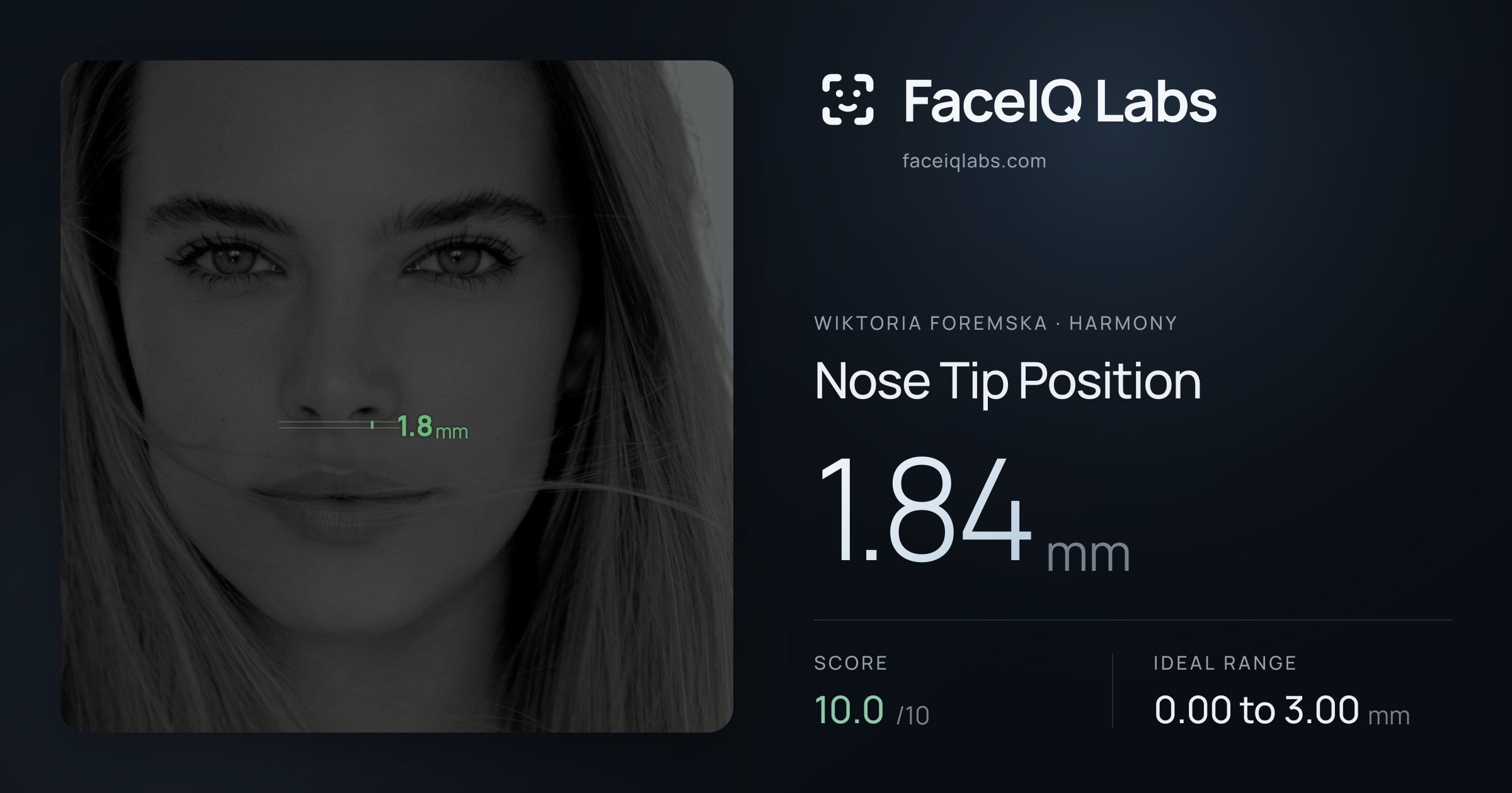 Wiktoria Foremska Nose Tip Position: 1.84mm, drawn on the photo