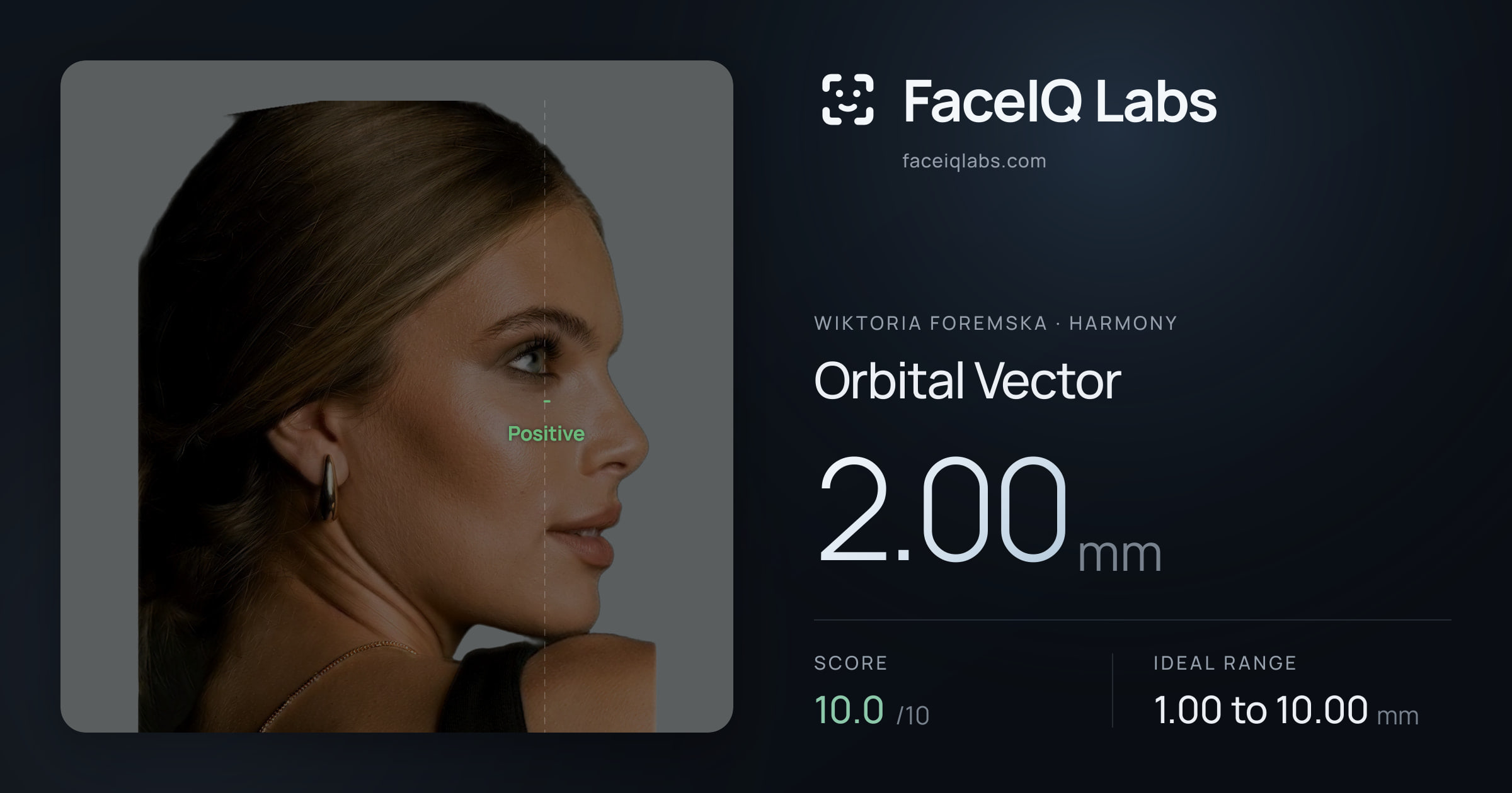 Wiktoria Foremska Orbital Vector: 2.00mm, drawn on the photo