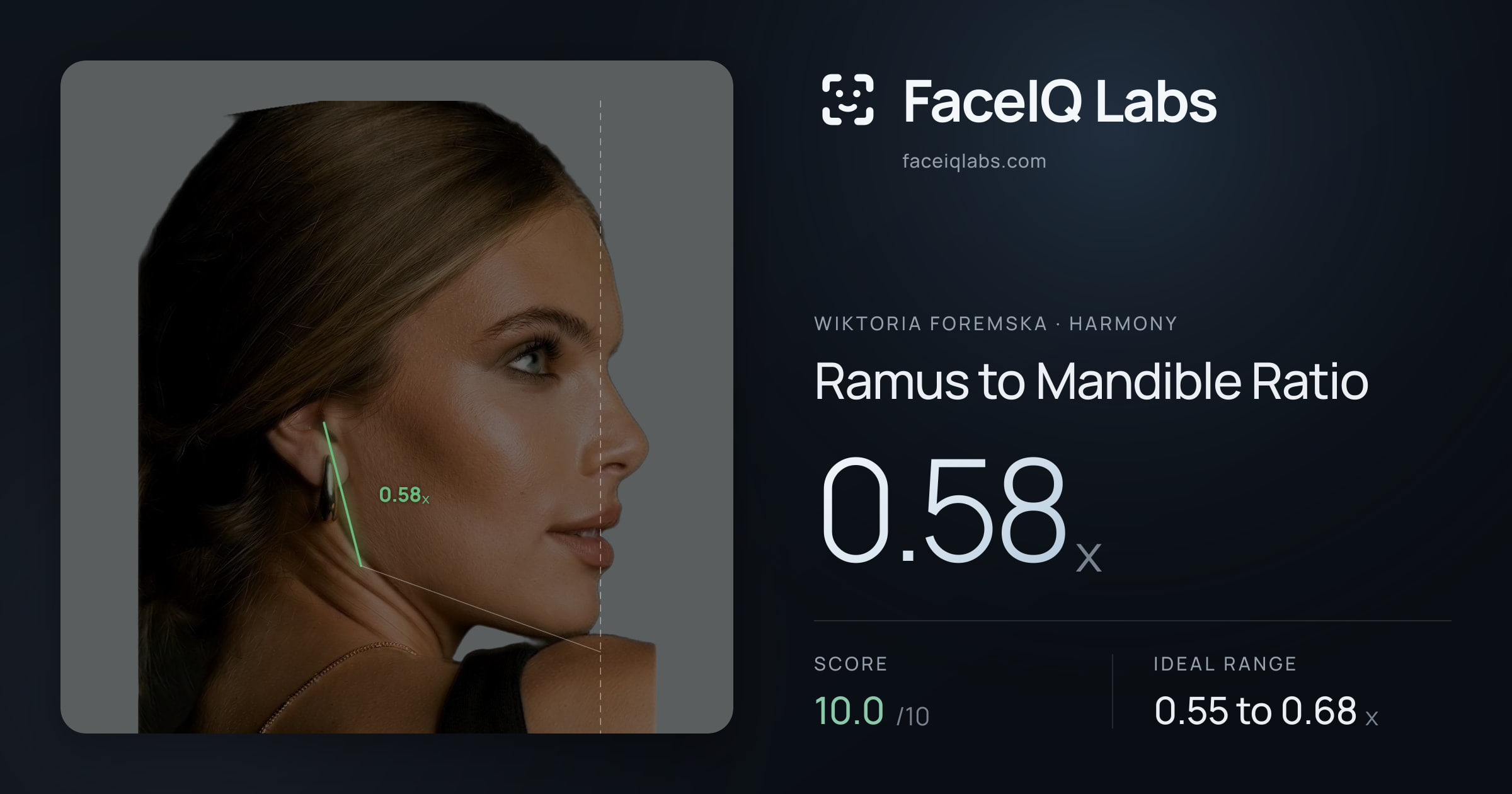 Wiktoria Foremska Ramus to Mandible Ratio: 0.58x, drawn on the photo
