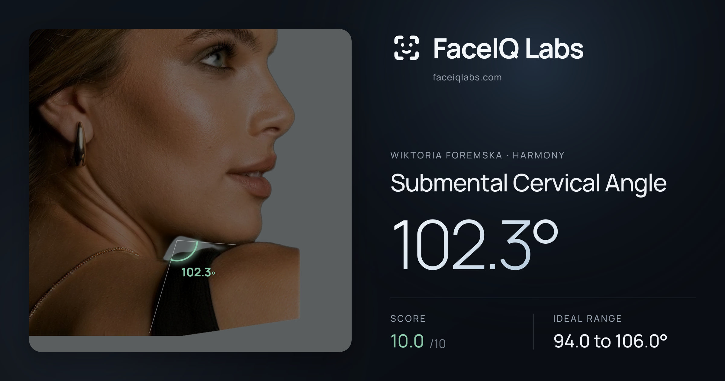 Wiktoria Foremska Submental Cervical Angle: 102.3°, drawn on the photo