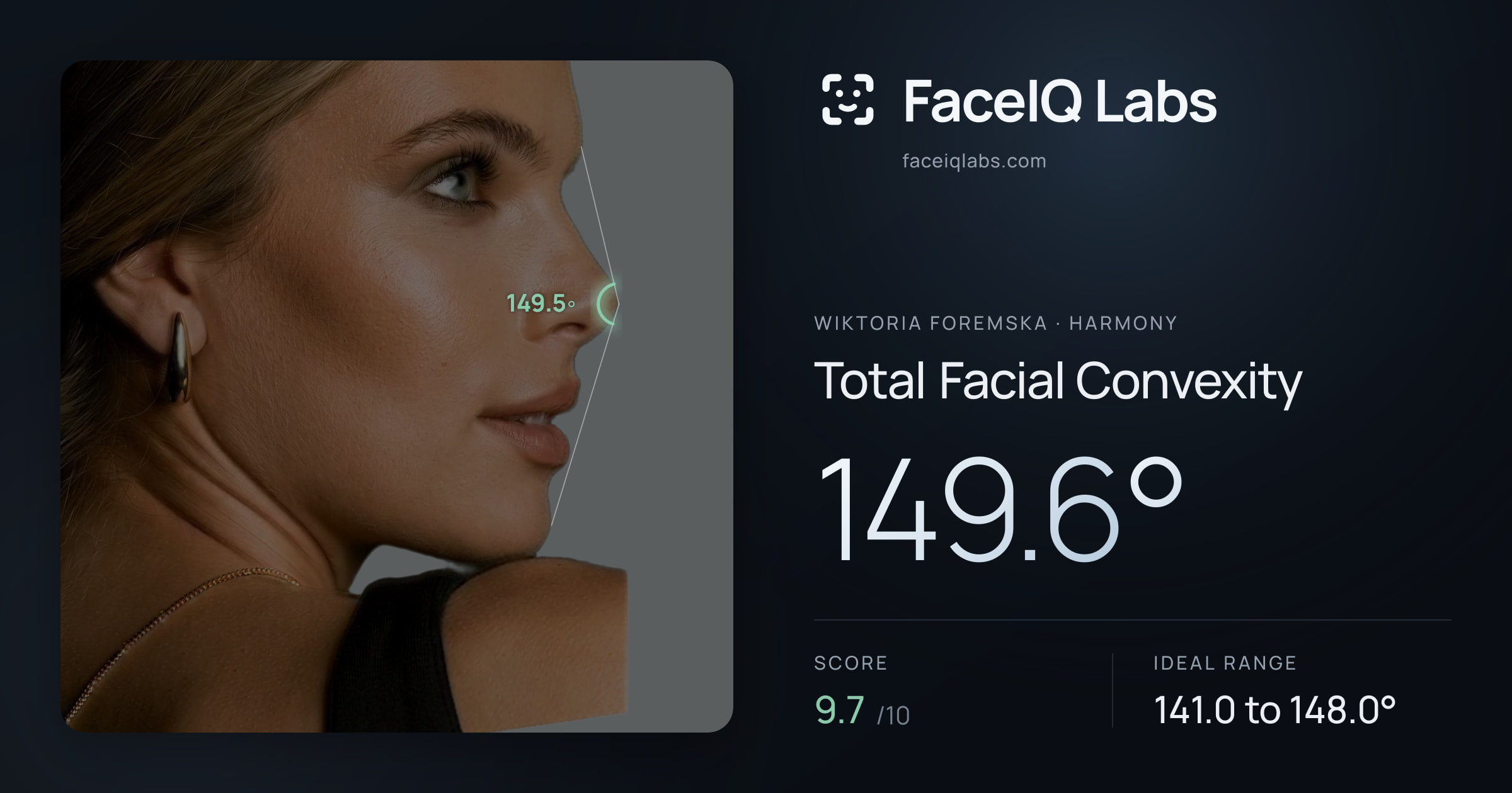 Wiktoria Foremska Total Facial Convexity: 149.6°, drawn on the photo