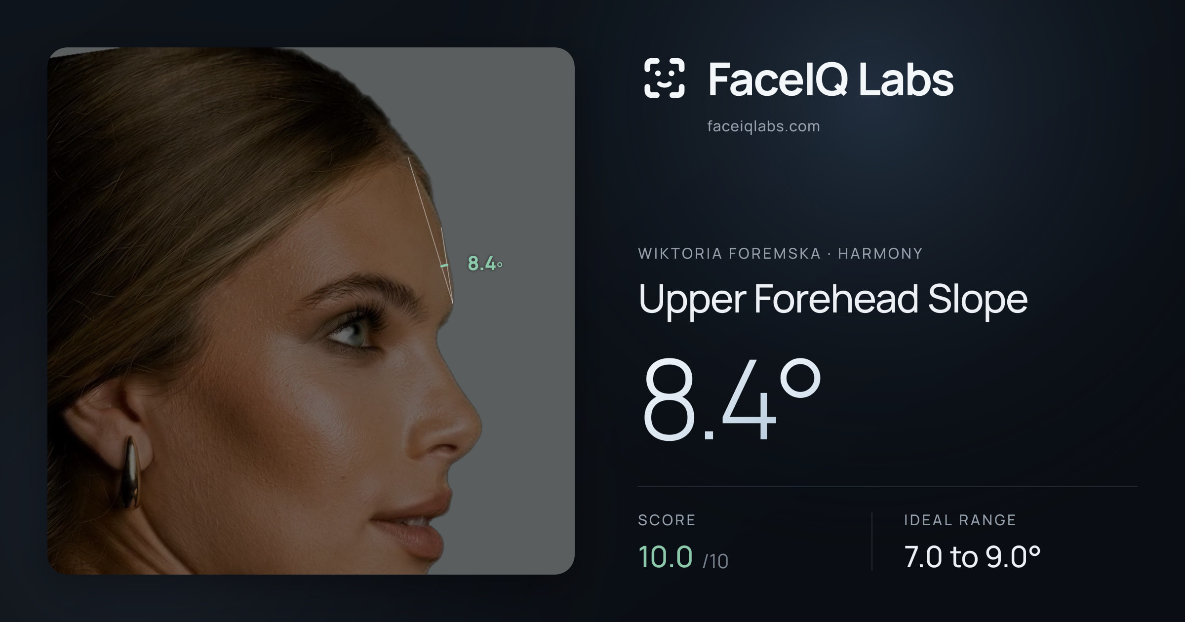 Wiktoria Foremska Upper Forehead Slope: 8.4°, drawn on the photo