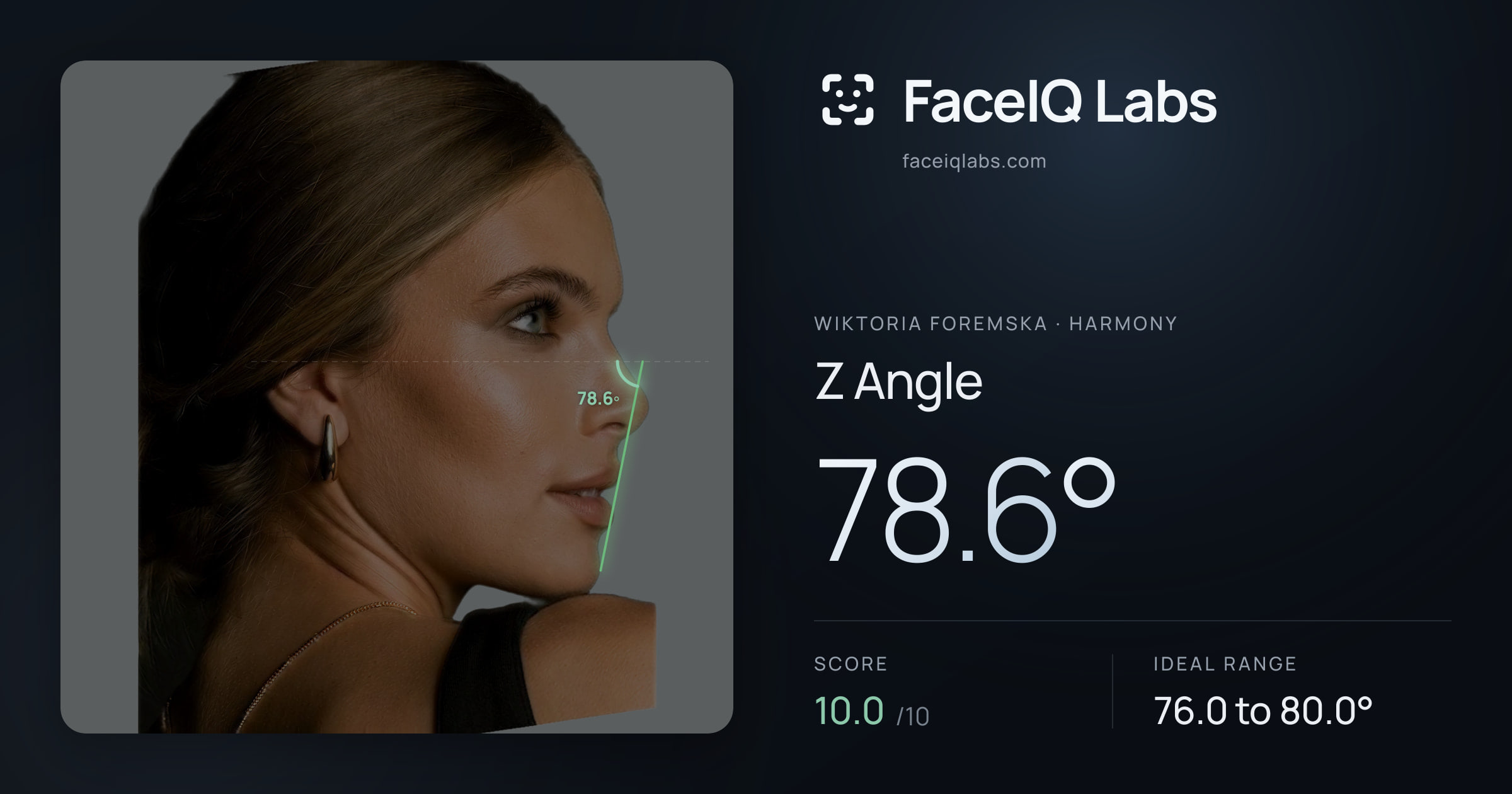 Wiktoria Foremska Z Angle: 78.6°, drawn on the photo