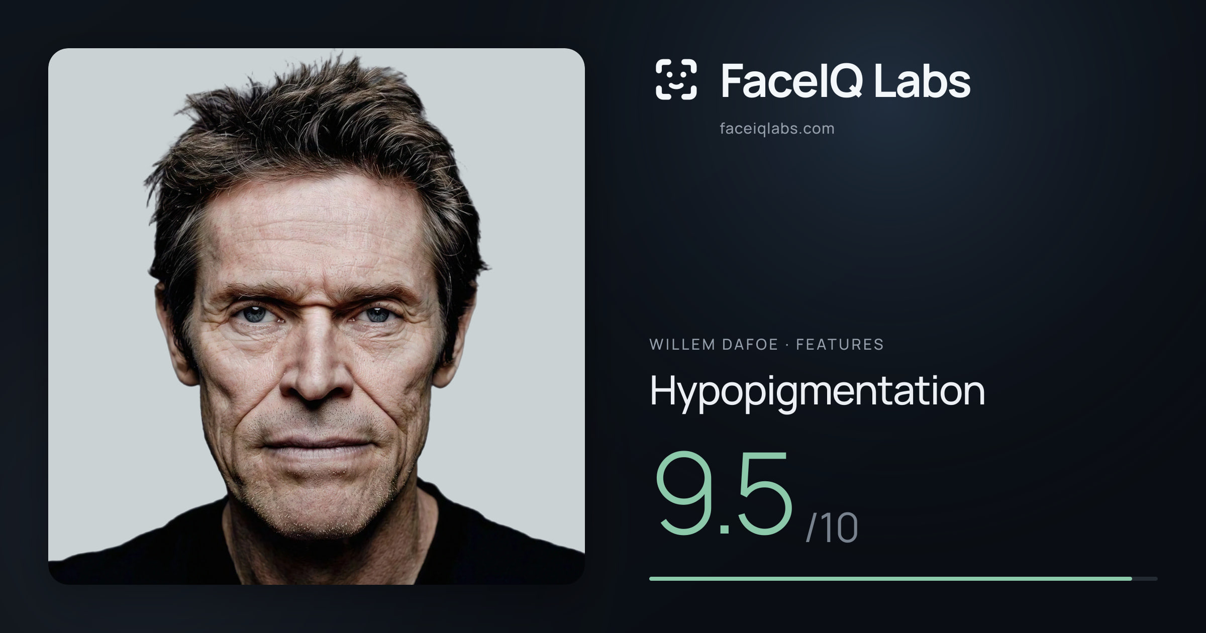 Willem Dafoe Hypopigmentation: 9.5/10, drawn on the photo