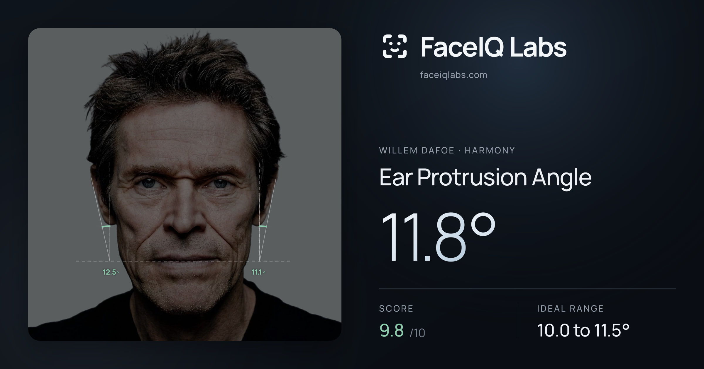 Willem Dafoe Ear Protrusion Angle: 11.8°, drawn on the photo