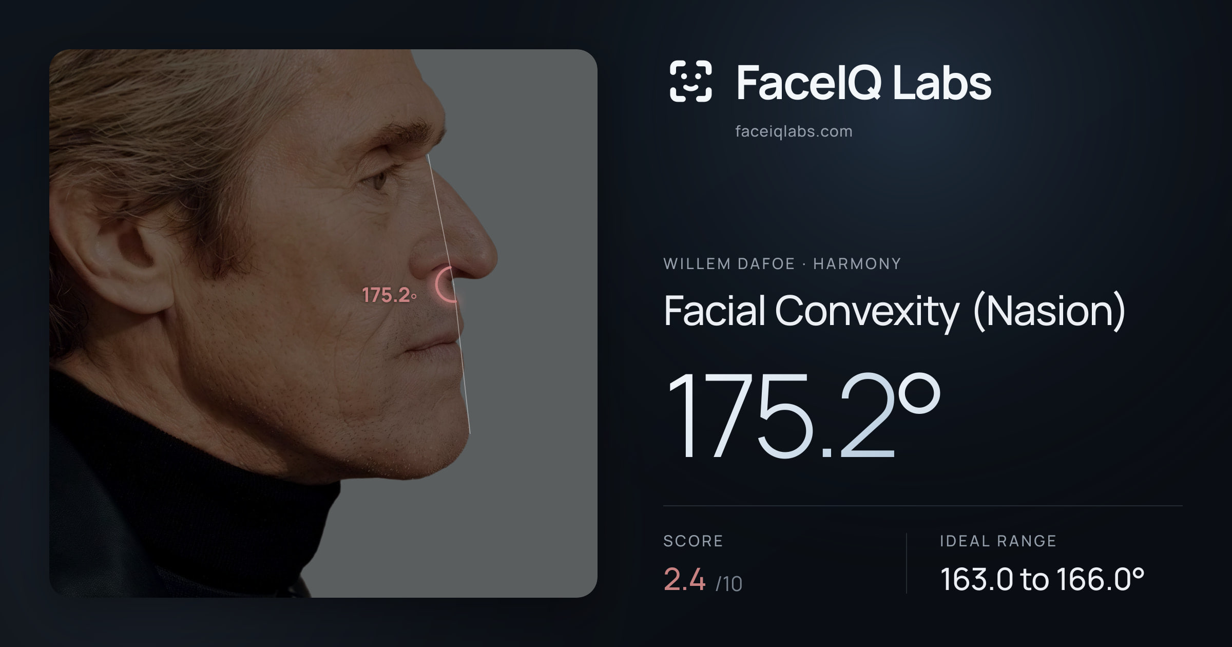 Willem Dafoe Facial Convexity (Nasion): 175.2°, drawn on the photo