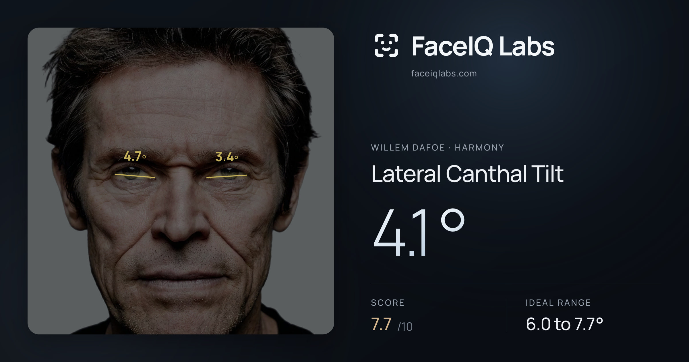Willem Dafoe Lateral Canthal Tilt: 4.1°, drawn on the photo
