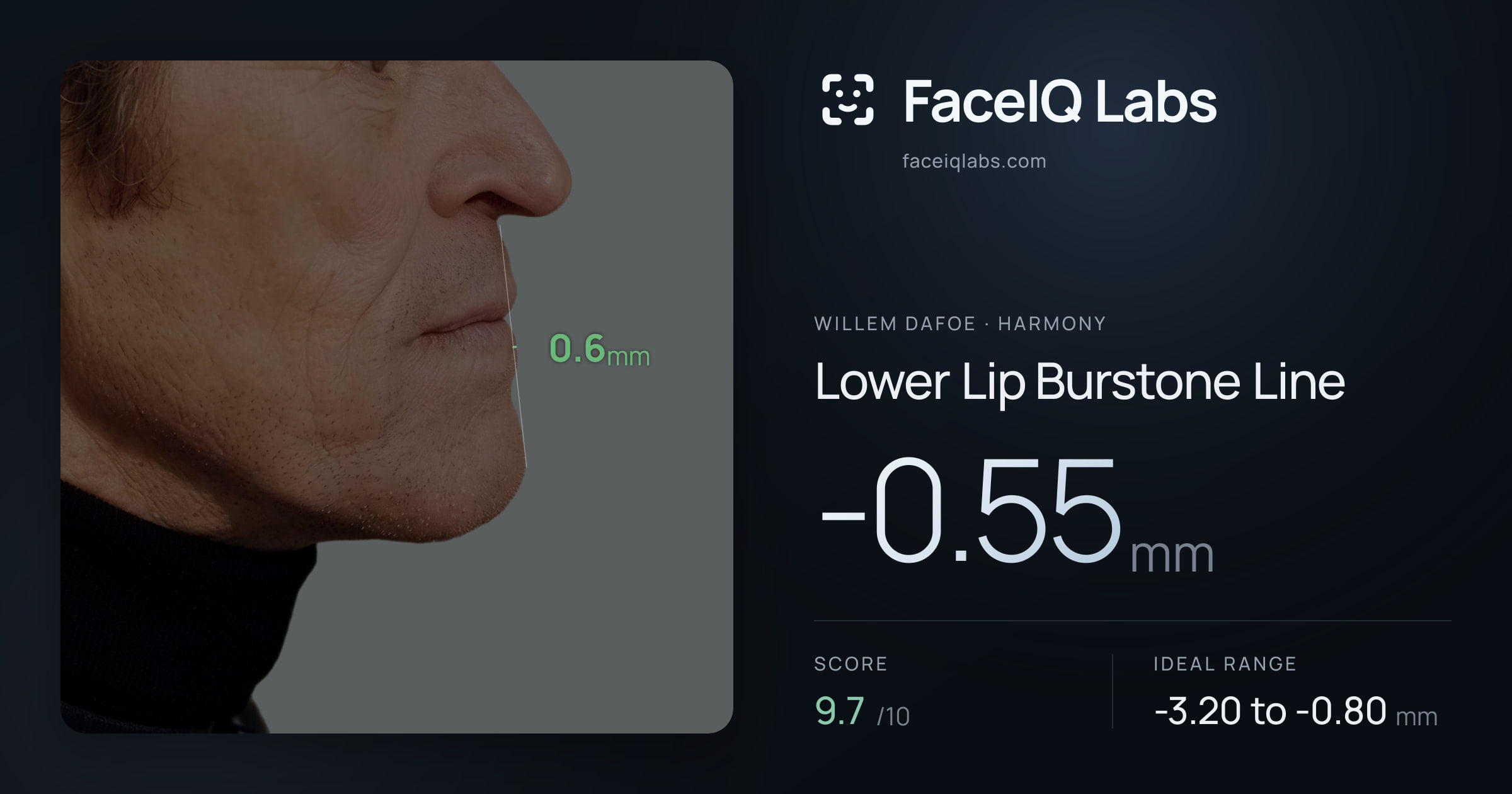 Willem Dafoe Lower Lip Burstone Line: -0.55mm, drawn on the photo