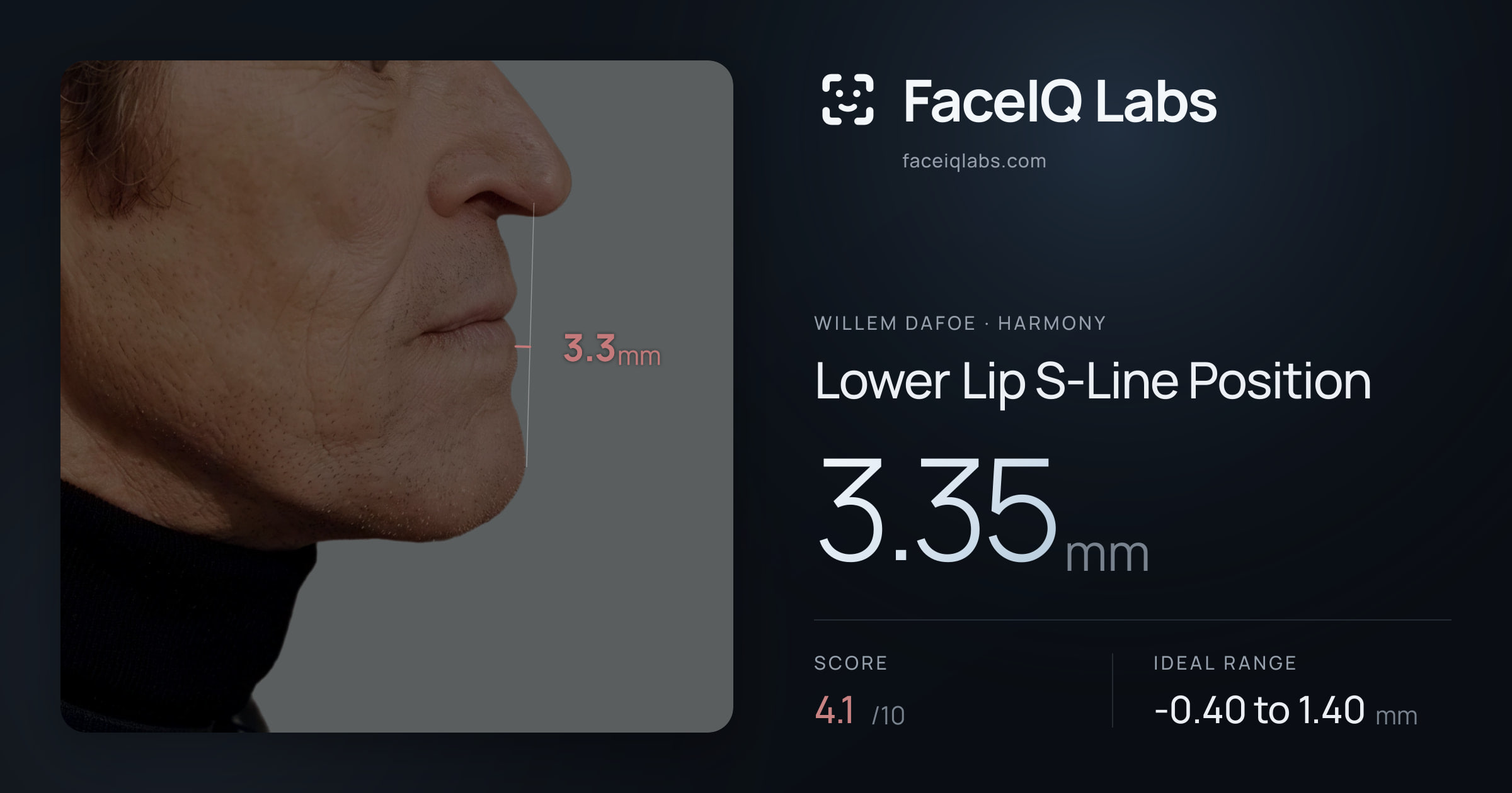 Willem Dafoe Lower Lip S-Line Position: 3.35mm, drawn on the photo