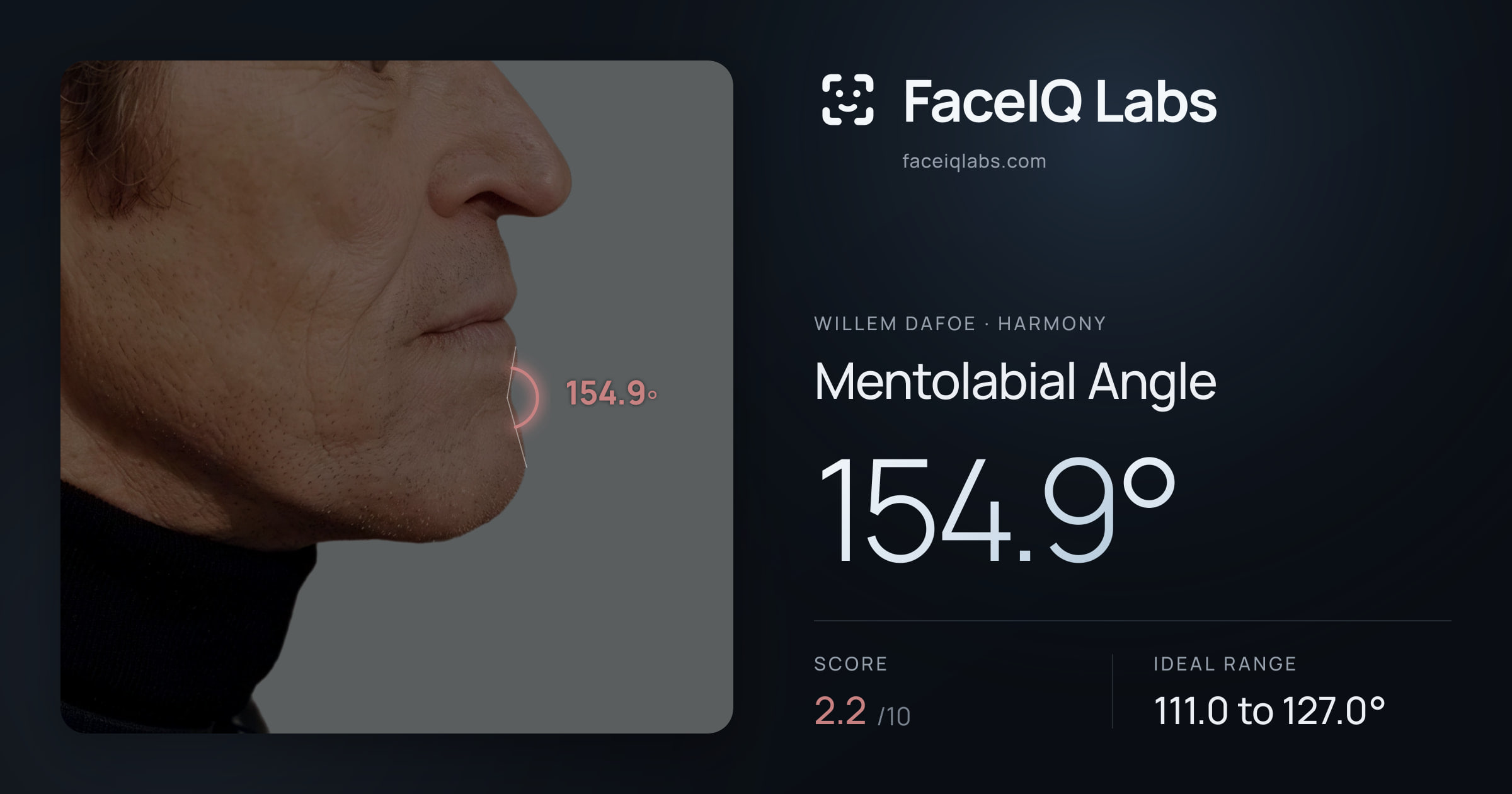 Willem Dafoe Mentolabial Angle: 154.9°, drawn on the photo