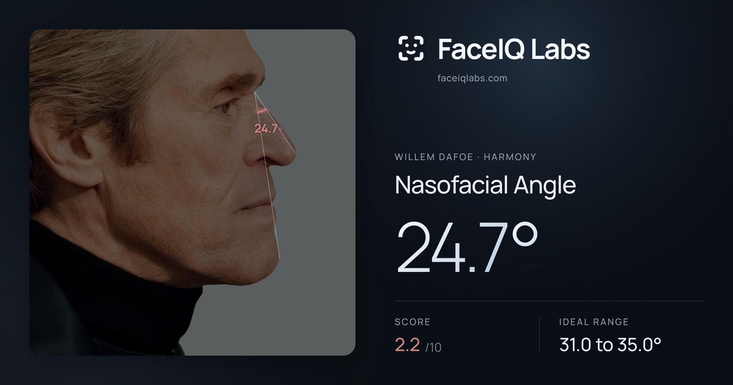 Willem Dafoe Nasofacial Angle: 24.7°, drawn on the photo