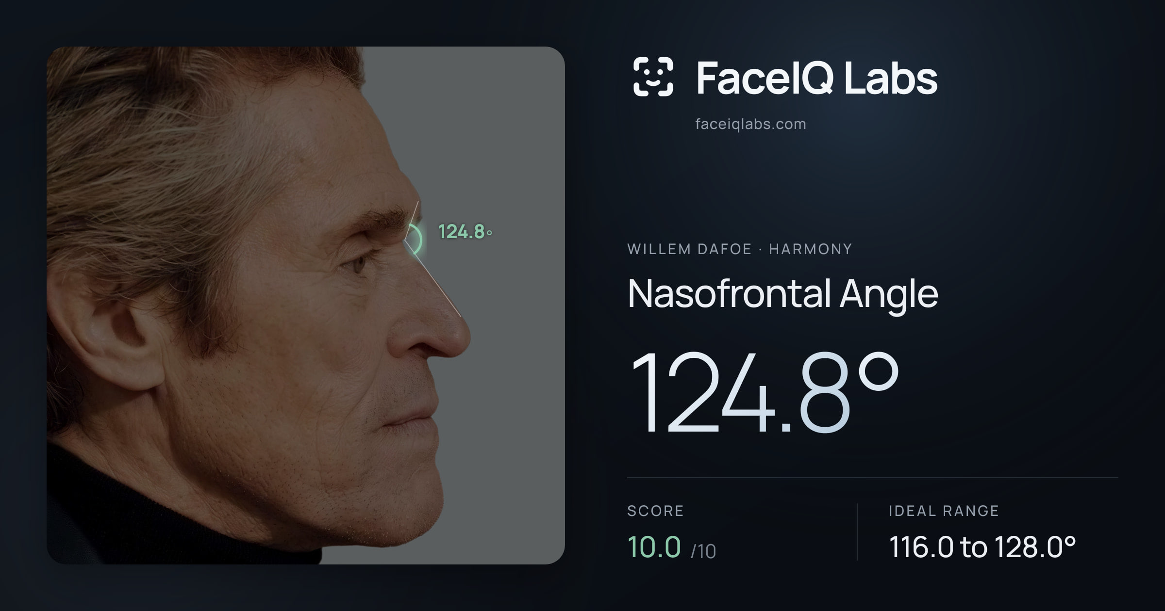 Willem Dafoe Nasofrontal Angle: 124.8°, drawn on the photo