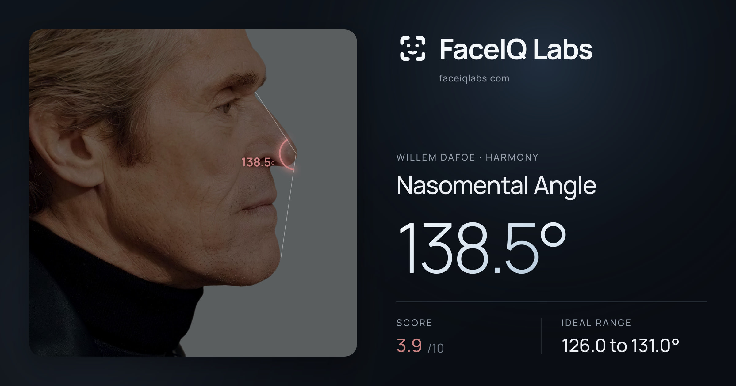 Willem Dafoe Nasomental Angle: 138.5°, drawn on the photo